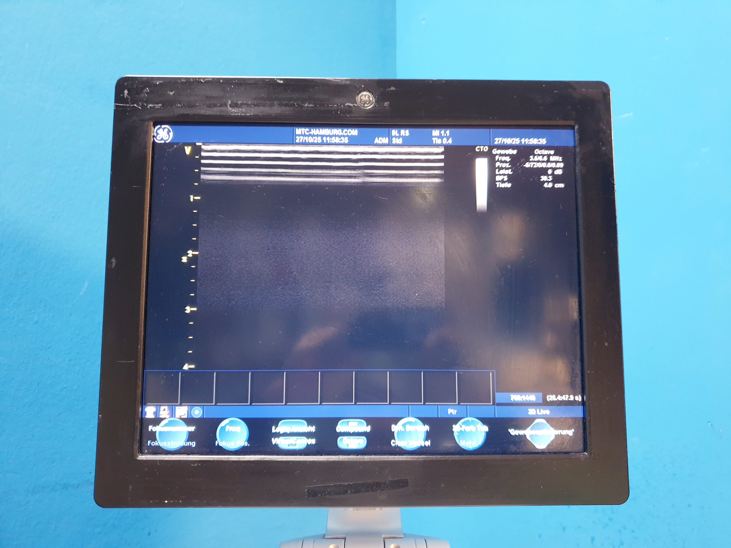 GE Vivid S6 S 6 Ultraschallgerät – Farbdoppler + 9L Linear Sonde Anschlüsse sind defekt thumbnail 15