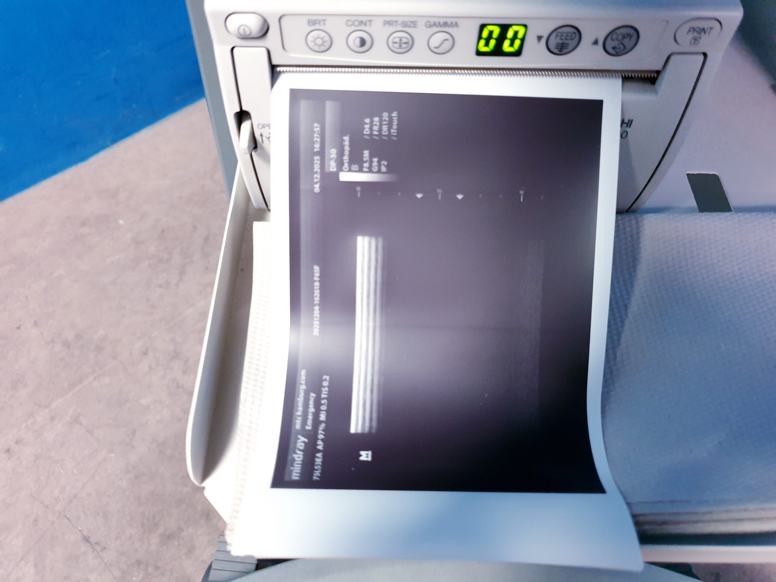 Mindray DP-50 DP50 mit 75L53EA Linear Sonde – auf Trolley thumbnail 5