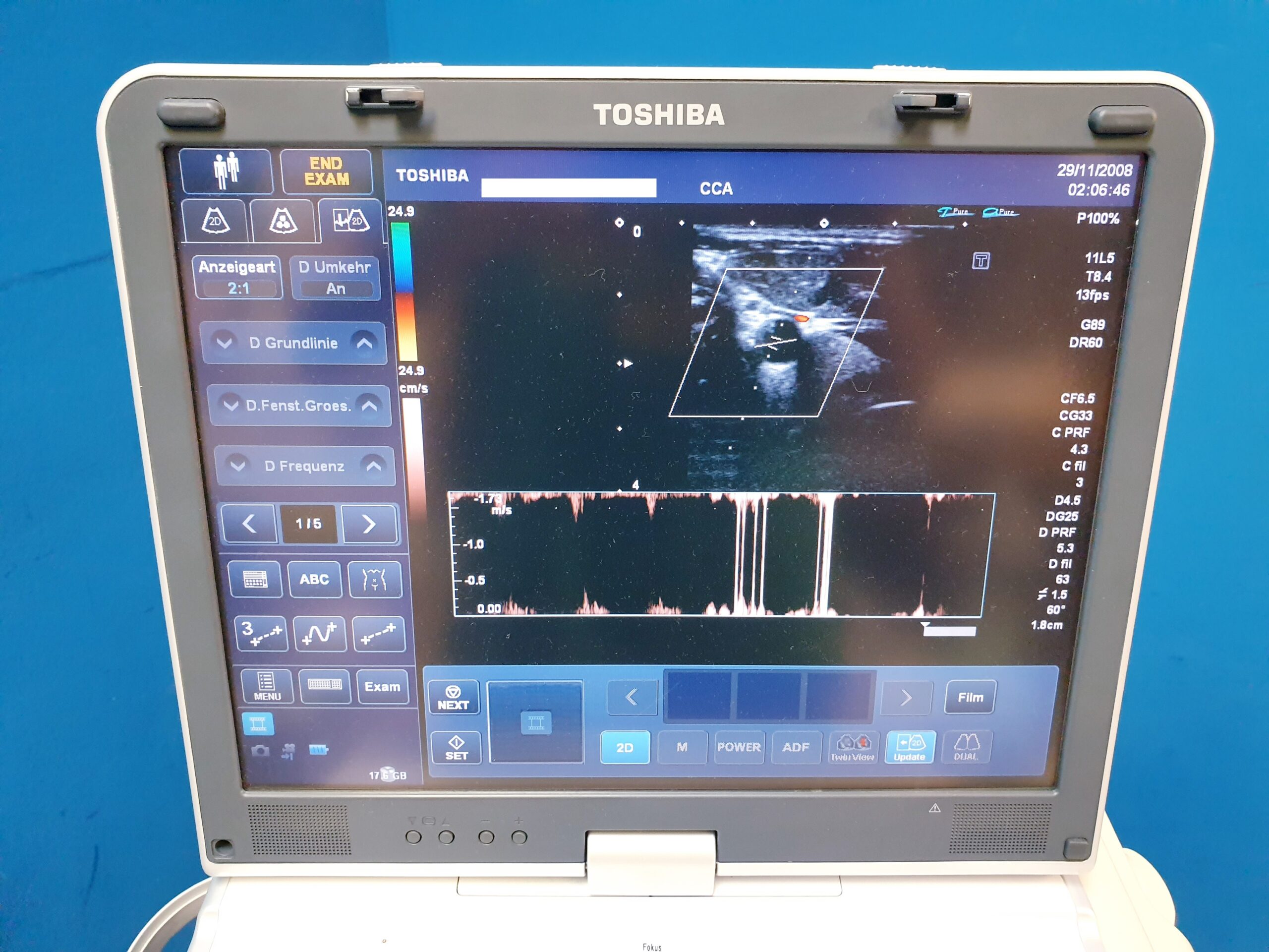 Toshiba Viamo UPS-640A PLT-704AT + PVT-375ST – Doppler thumbnail 22