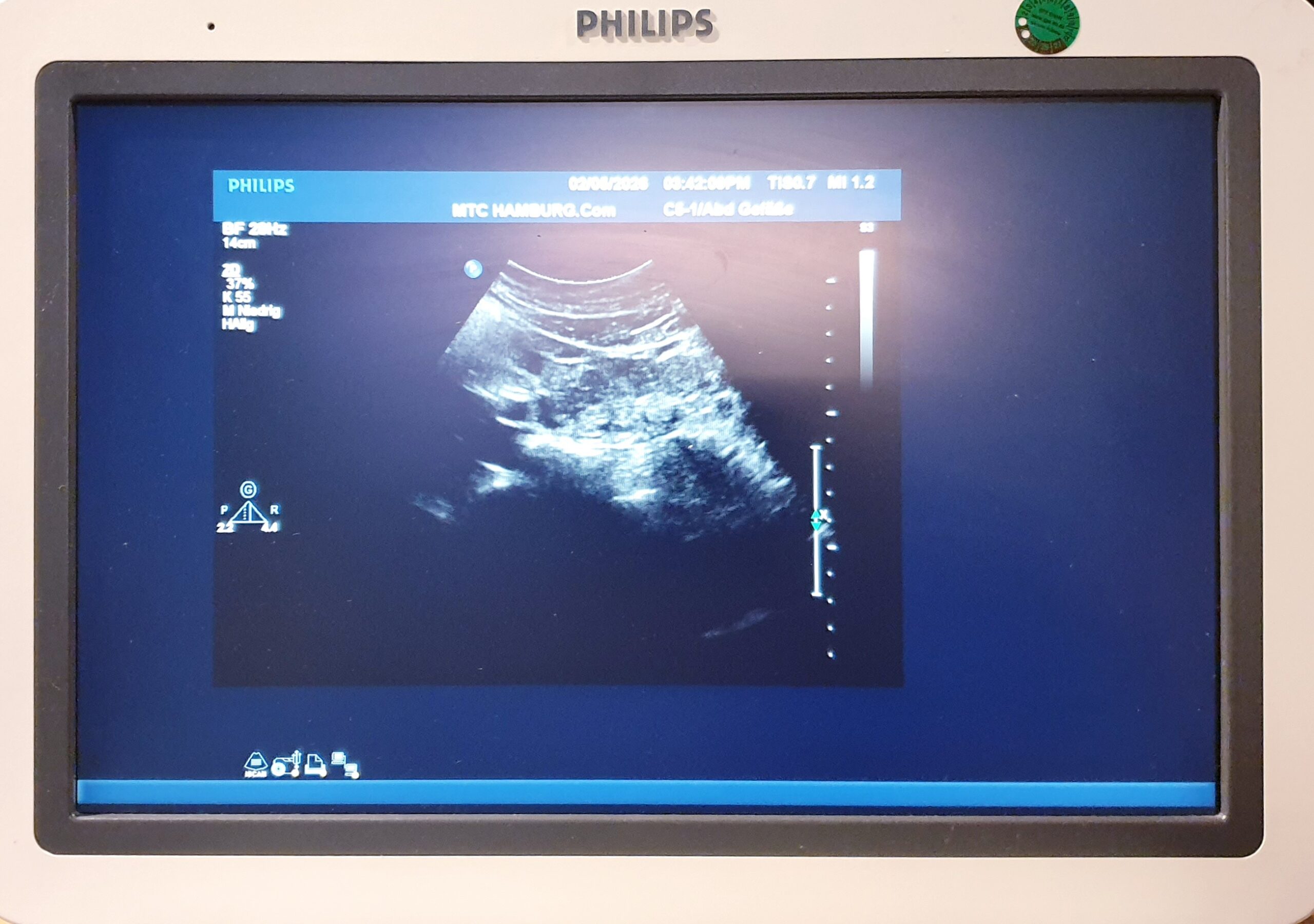 Philips C5-1 PureWave Breitband-Convex-Schallkopf Konvex — image 1 of 9