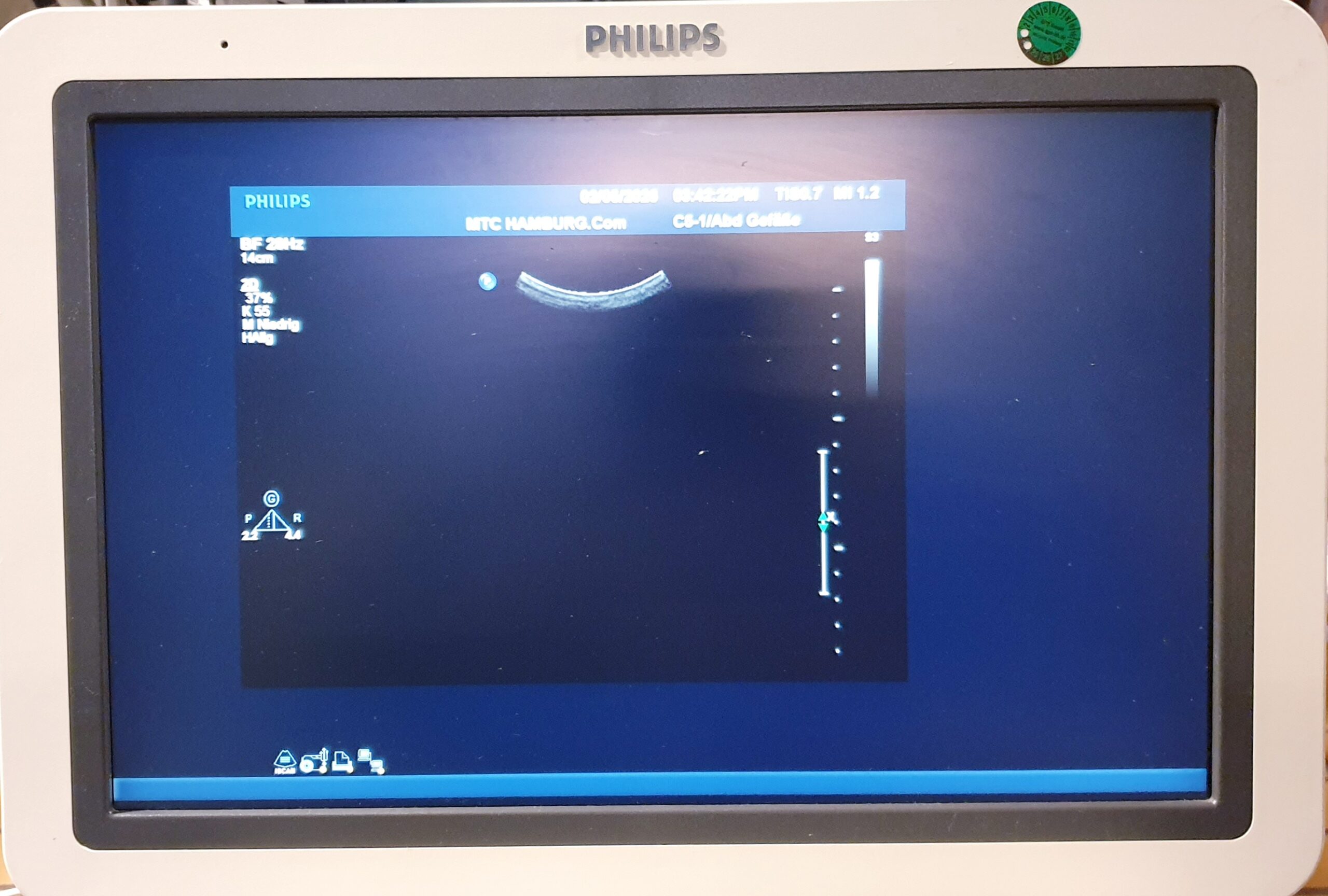 Philips C5-1 PureWave Breitband-Convex-Schallkopf Konvex thumbnail 2