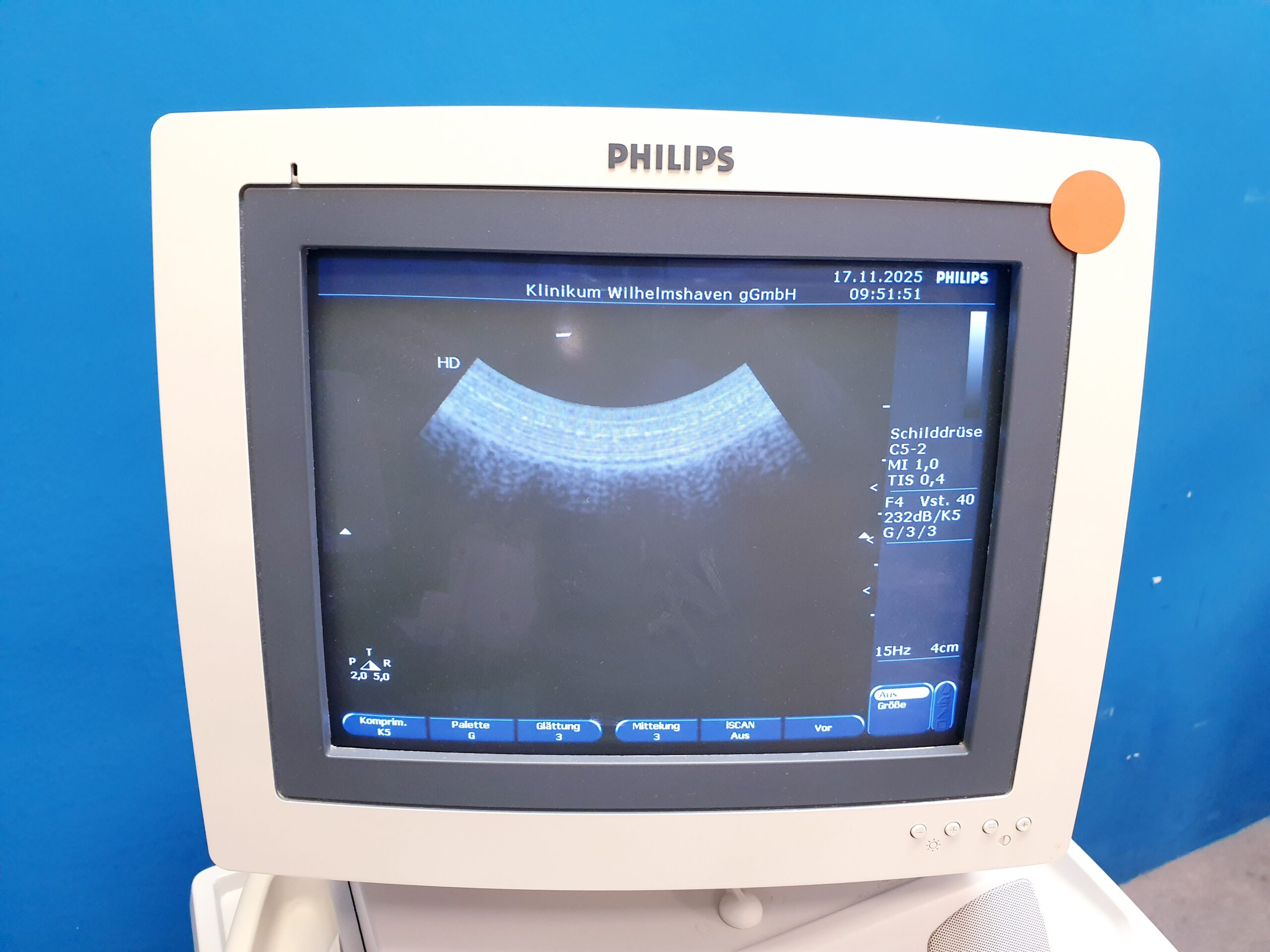 Philips C5-2 Ultraschallsonde Konvex Sonde thumbnail 4