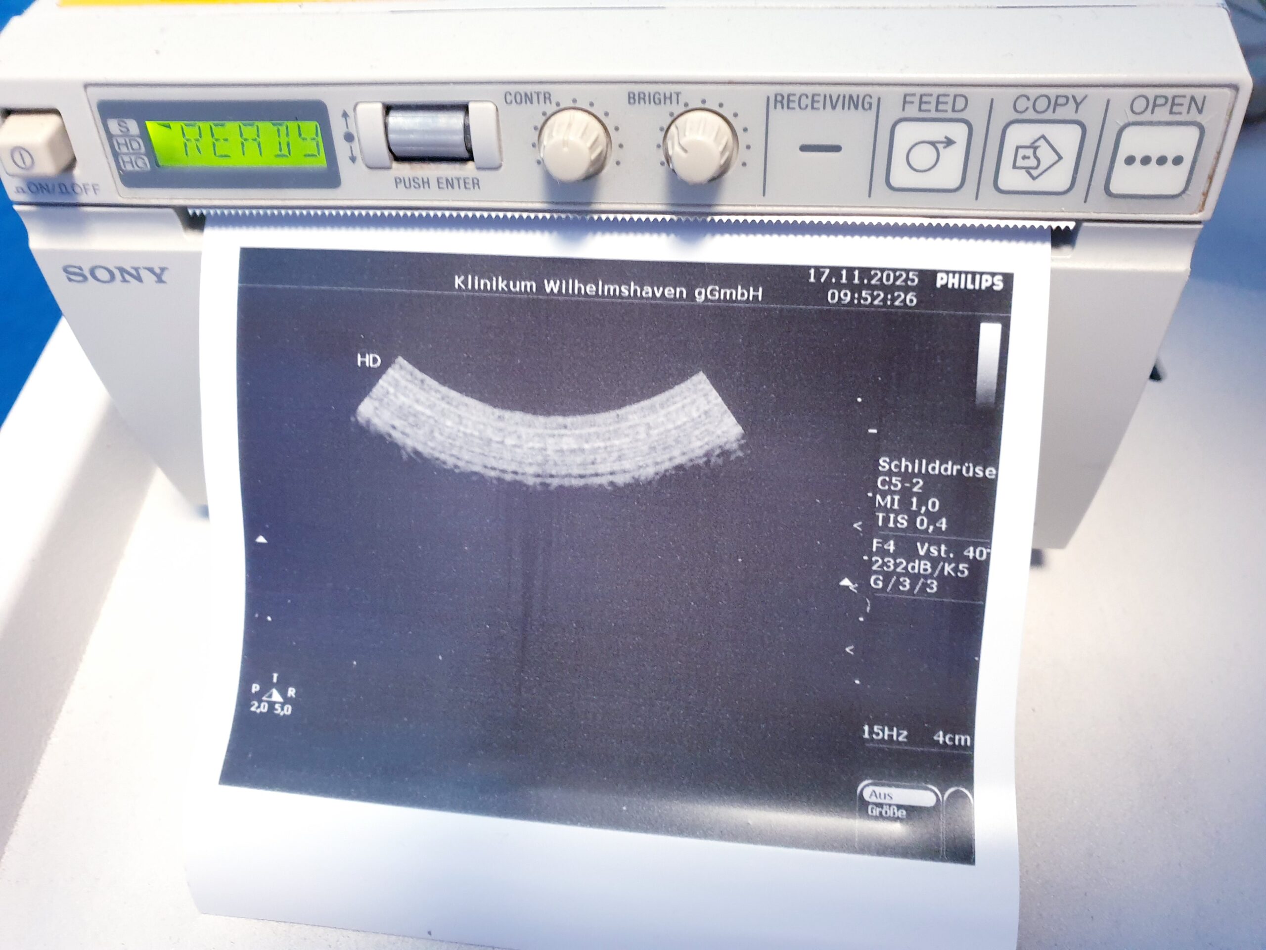 Philips C5-2 Ultraschallsonde Konvex Sonde thumbnail 5