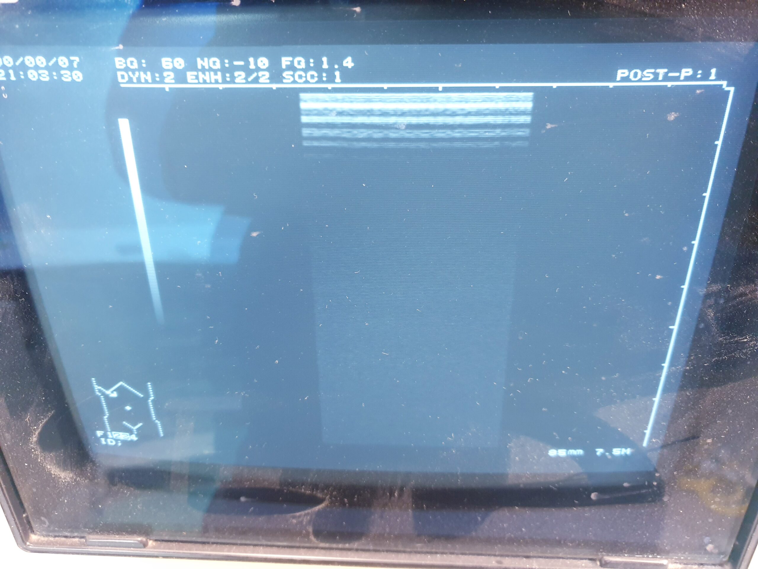 Hitachi EUP-L33 Ultraschallsonde thumbnail 3