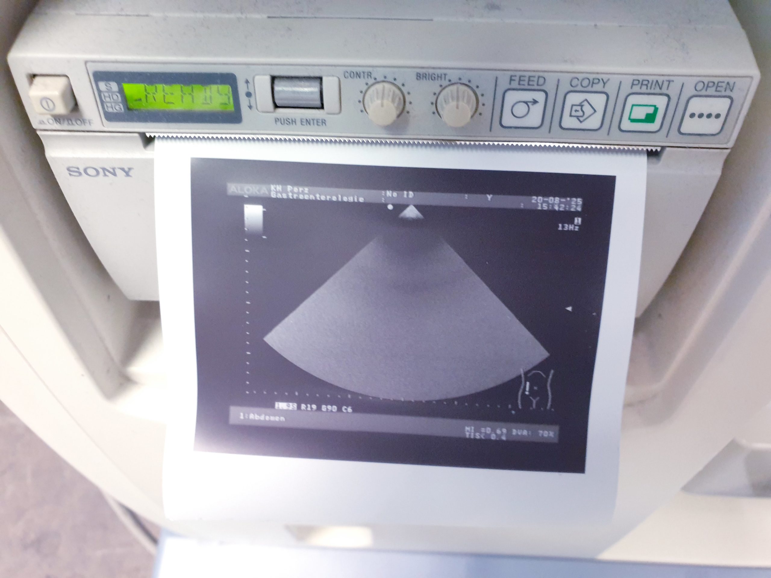 Aloka UST-52101 52101 Kardio – Echosonde thumbnail 4