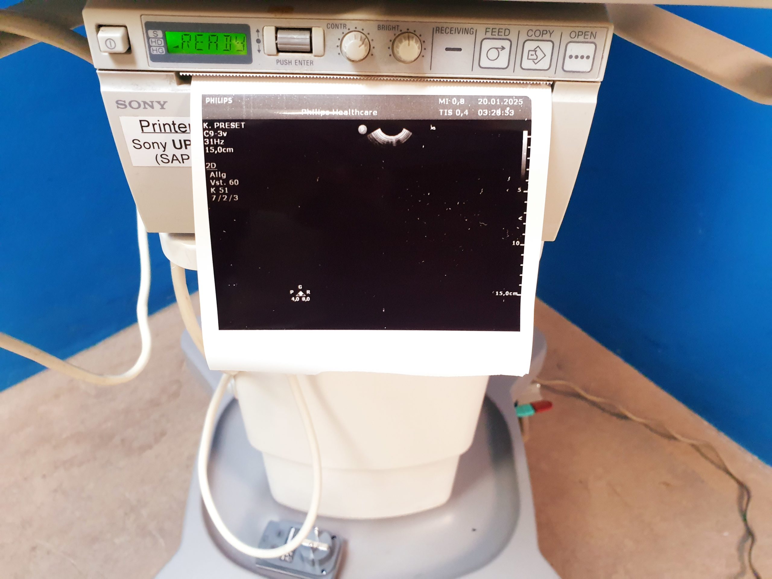 Philips Transducer C9-3V Ultrasound Probe thumbnail 2