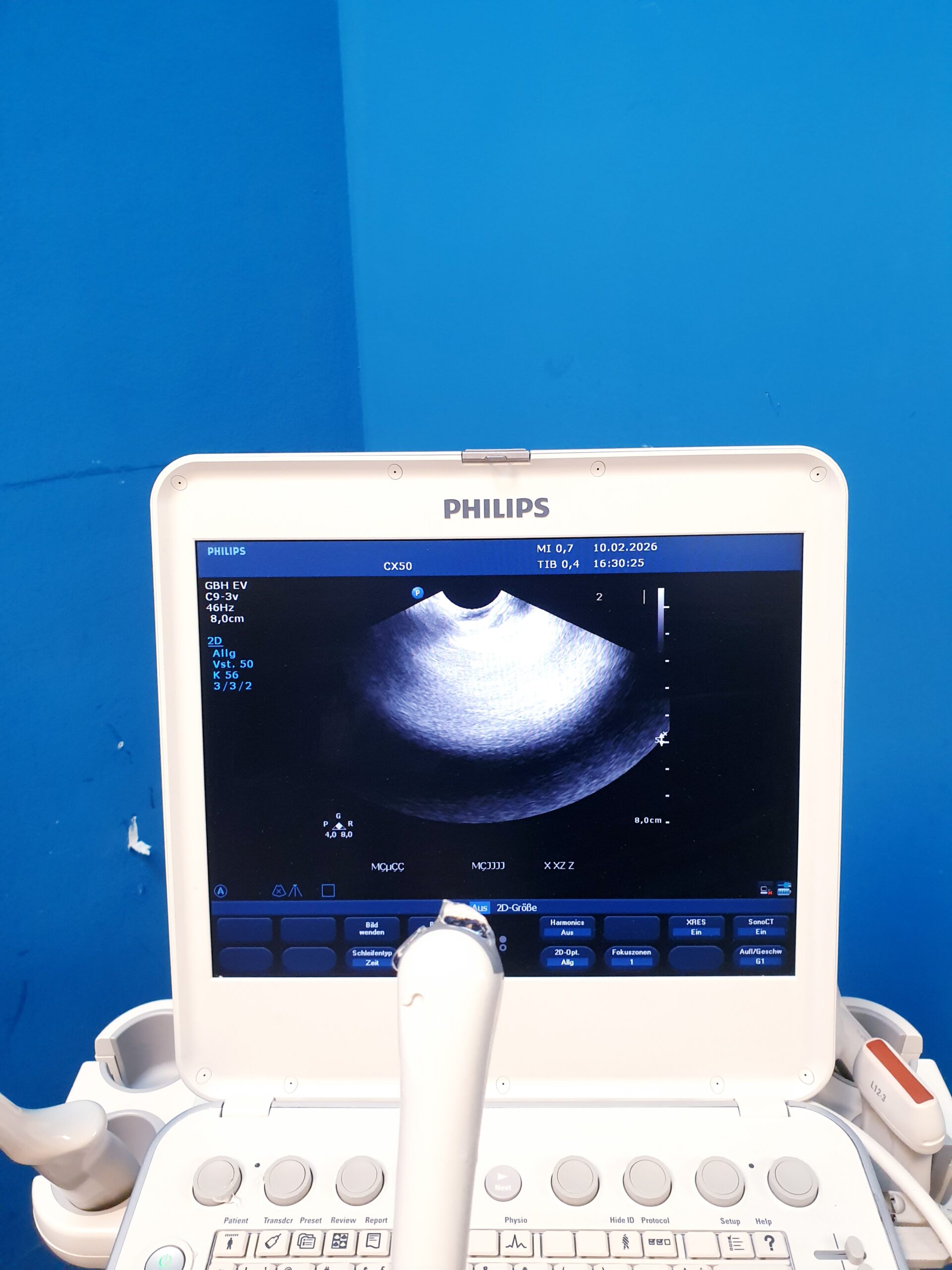 Philips Transducer C9-3V Ultrasound Probe thumbnail 20