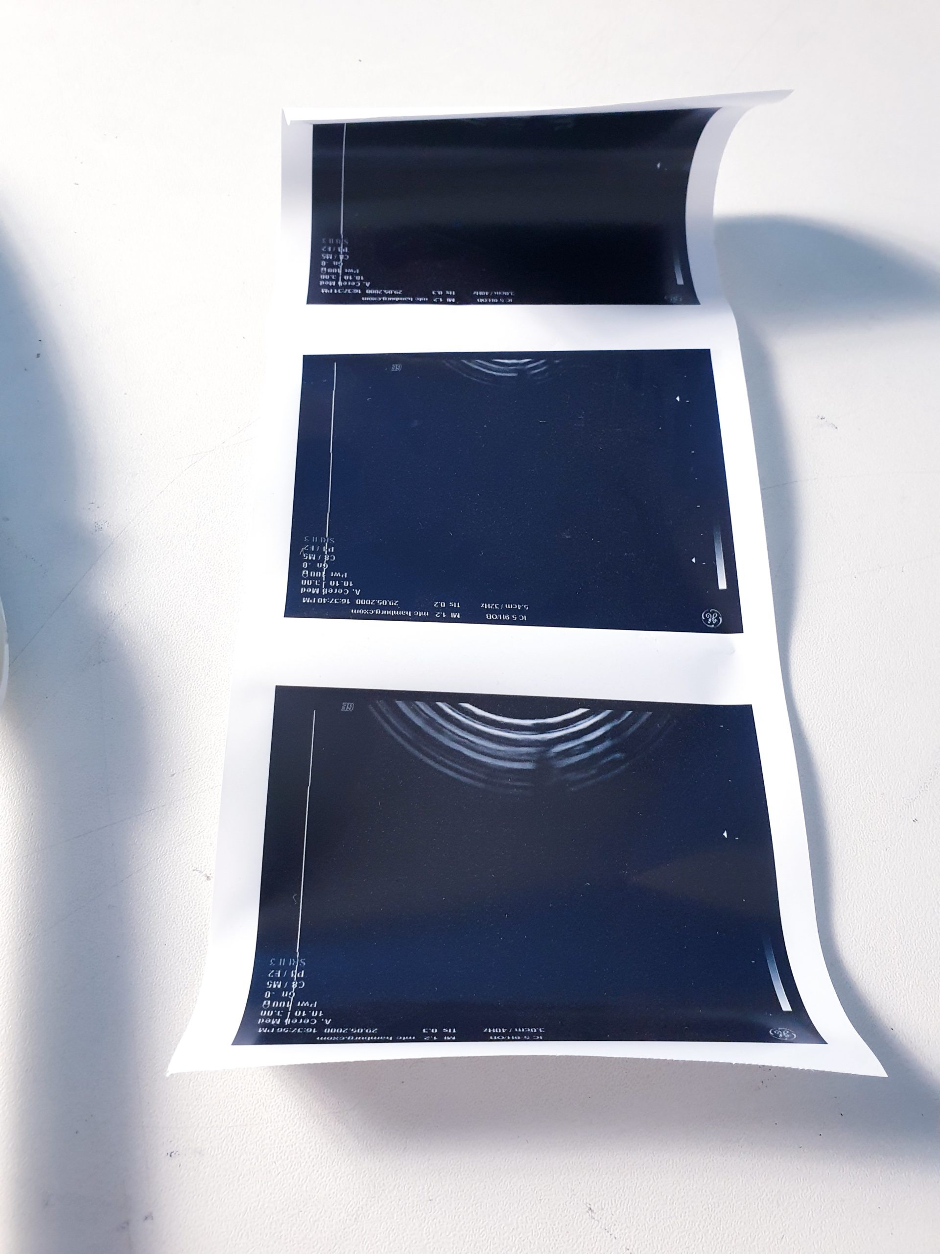 GE IC5-9H Endovaginale Sonde // Vaginalesonde für 730 Systeme — image 1 of 17