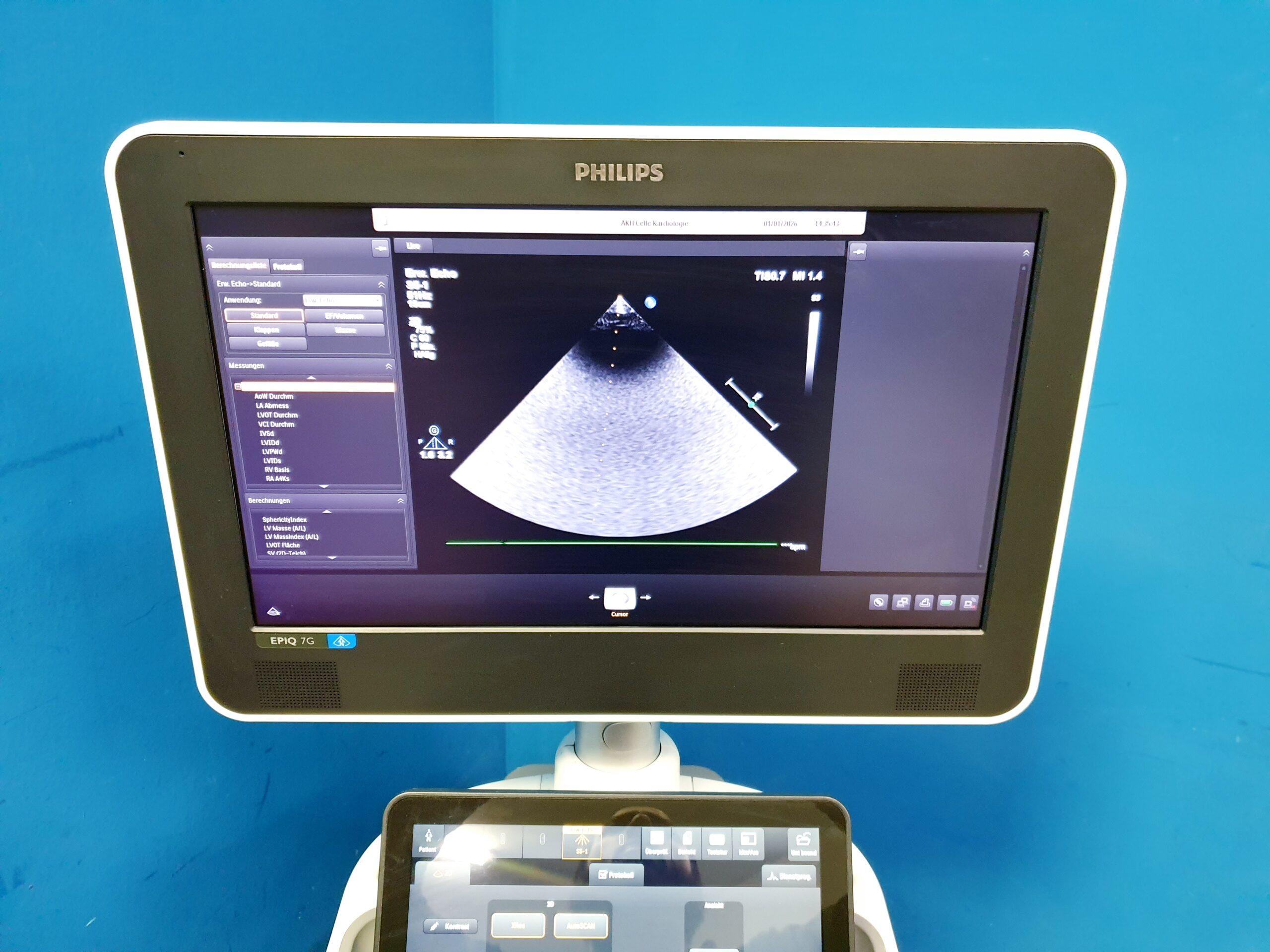 Philips EPIQ 7 Epiq7 + S5-1 Echosonde DOM 2015 thumbnail 8