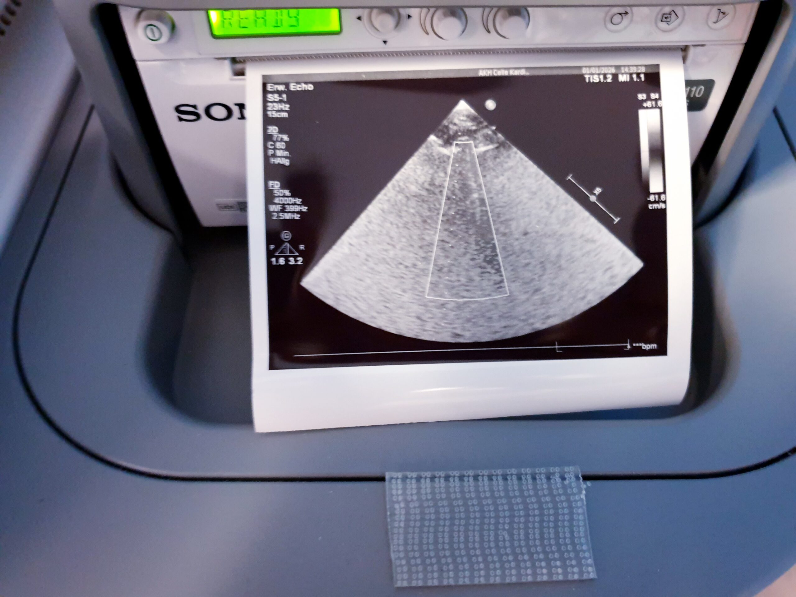 Philips EPIQ 7 Epiq7 + S5-1 Echosonde DOM 2015 thumbnail 11