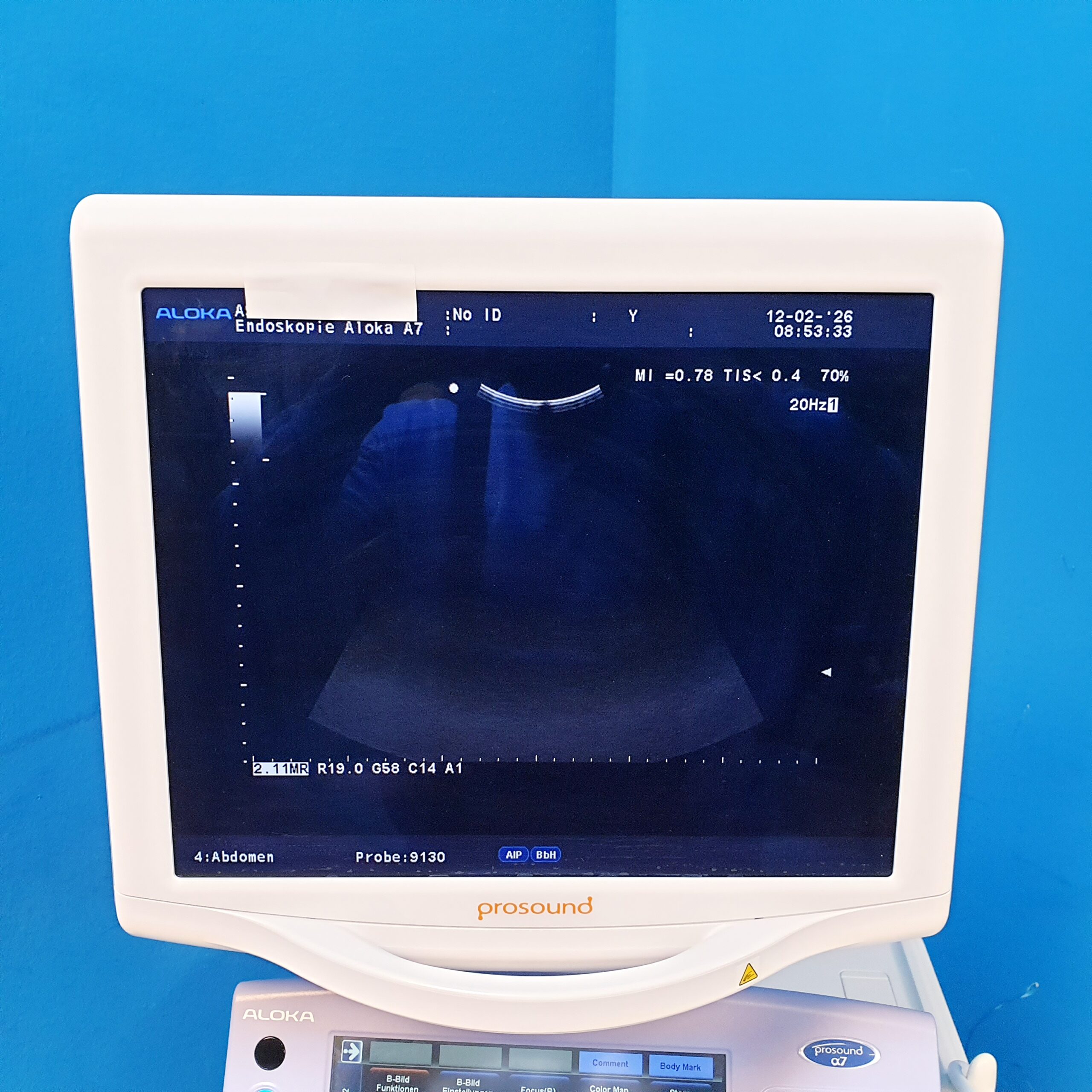 Aloka UST-9130 Ultraschallsonde thumbnail 9
