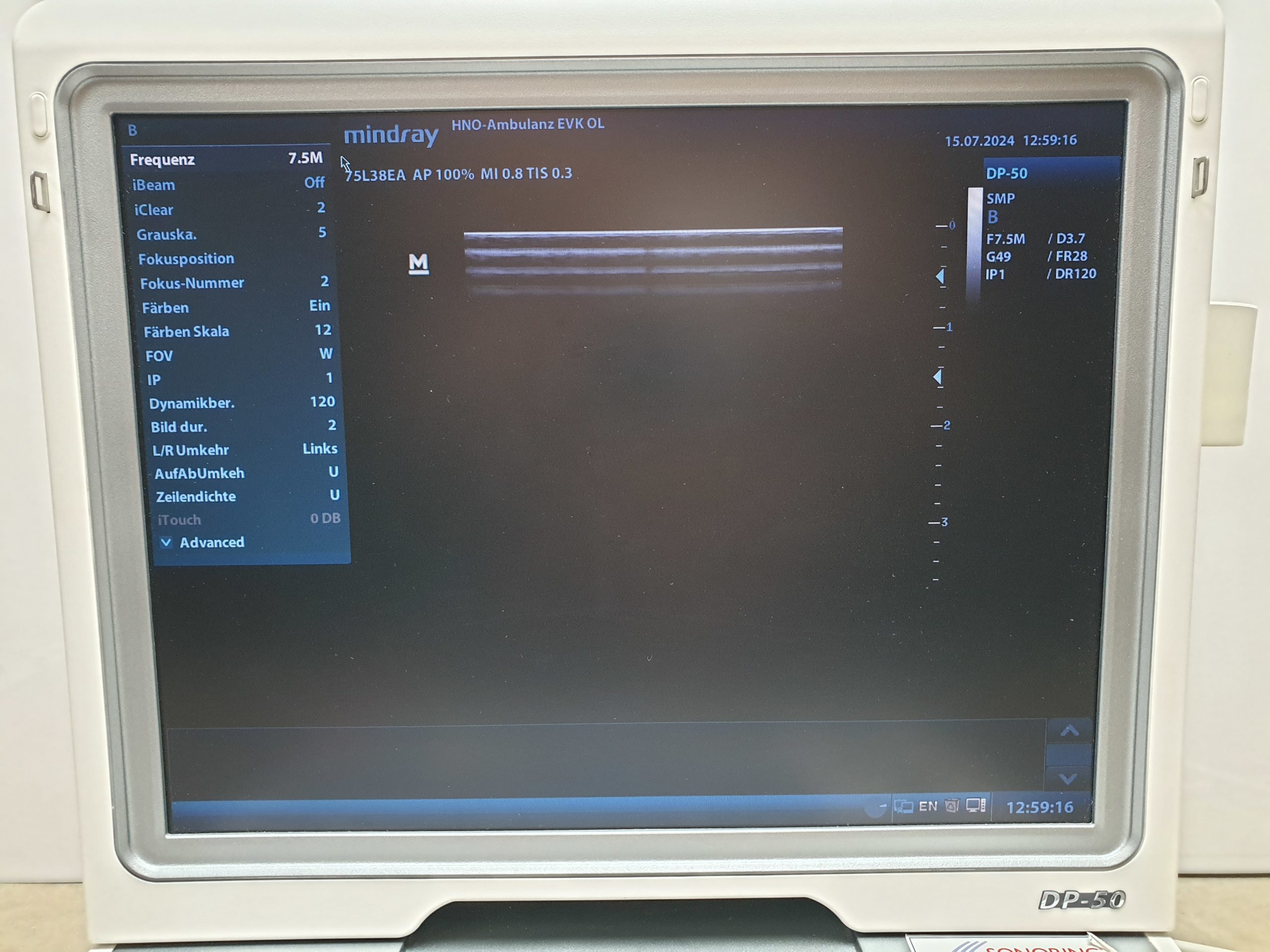 Mindray DP-50 DP50 mit 75L38 Linear Sonde thumbnail 11