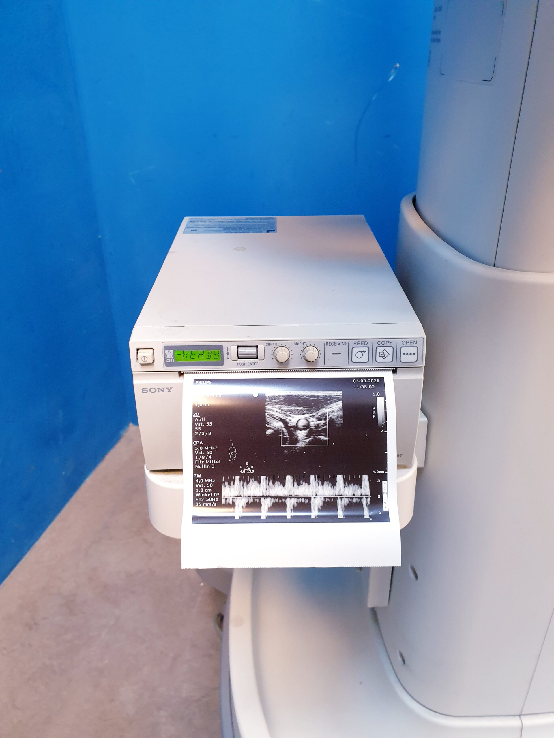 Philips Sparq Farbdoppler + L12-4 Linear Sonde thumbnail 8