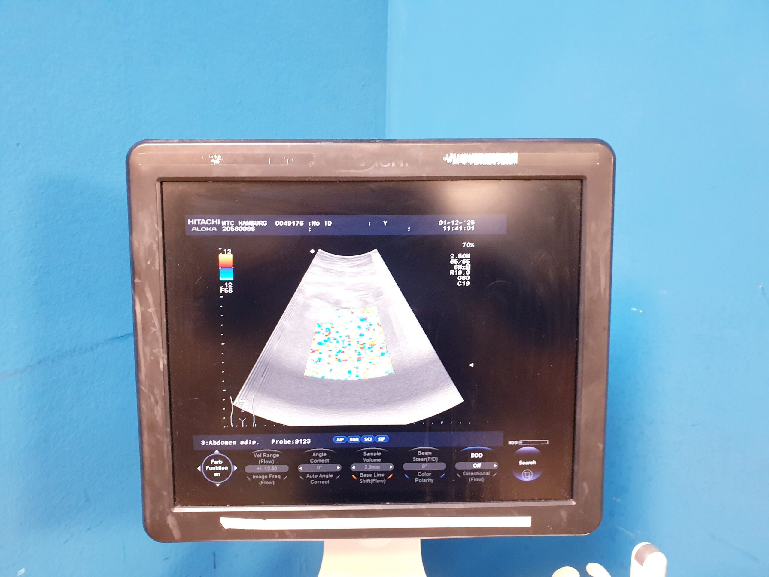 Hitachi Aloka F37 – F 37 + UST-9123 + UST-9124 Ultraschallsystem thumbnail 7