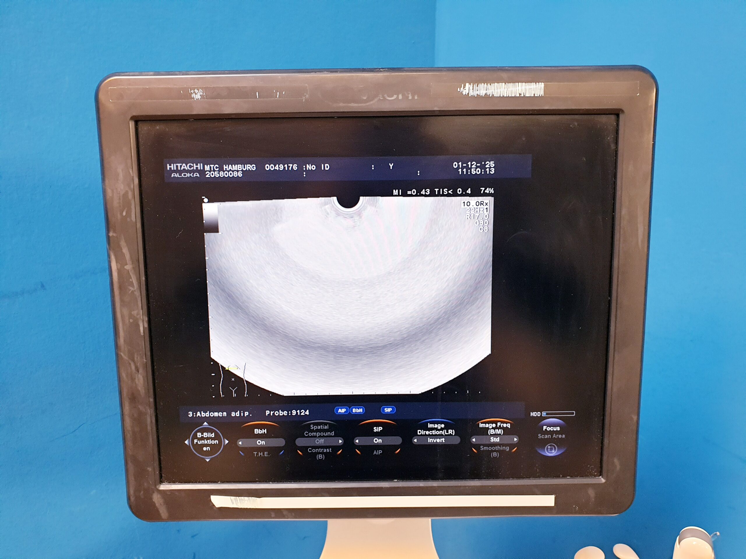 Hitachi Aloka F37 – F 37 + UST-9123 + UST-9124 Ultraschallsystem thumbnail 23