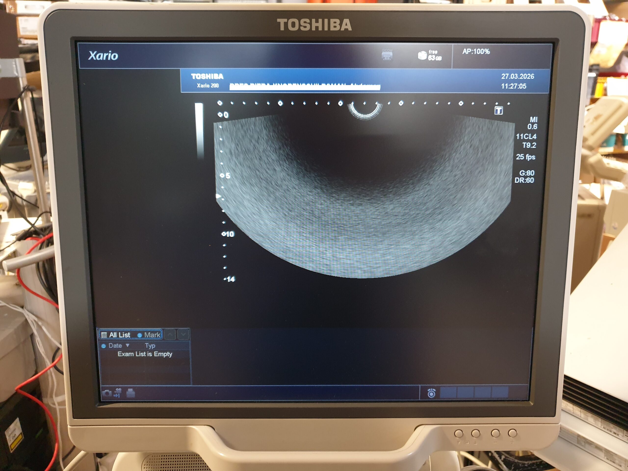 Toshiba 11CL4 – PVL-715RS Endokavitärsonde thumbnail 11