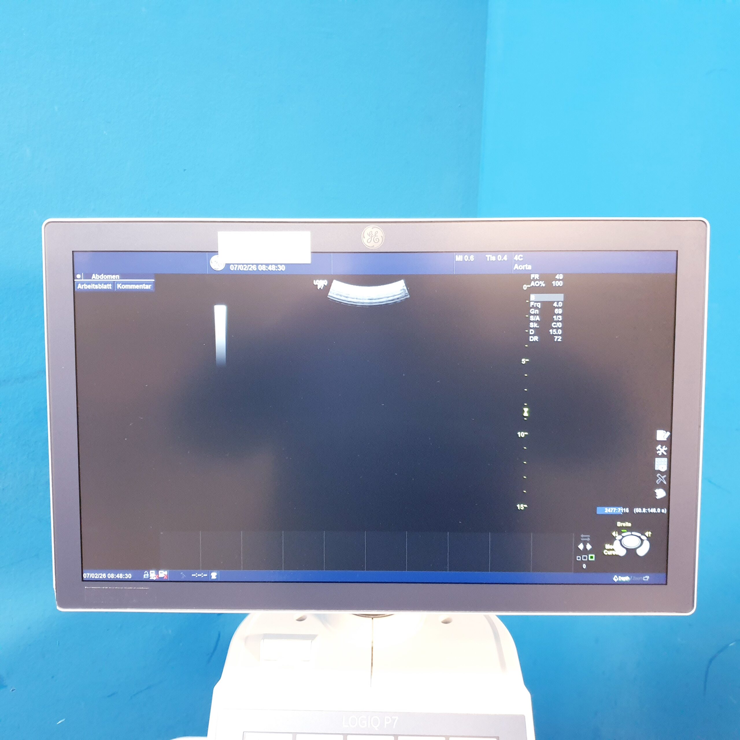 GE Logiq P7 P 7 + 4C konvex Sonde Ultraschallsystem thumbnail 8