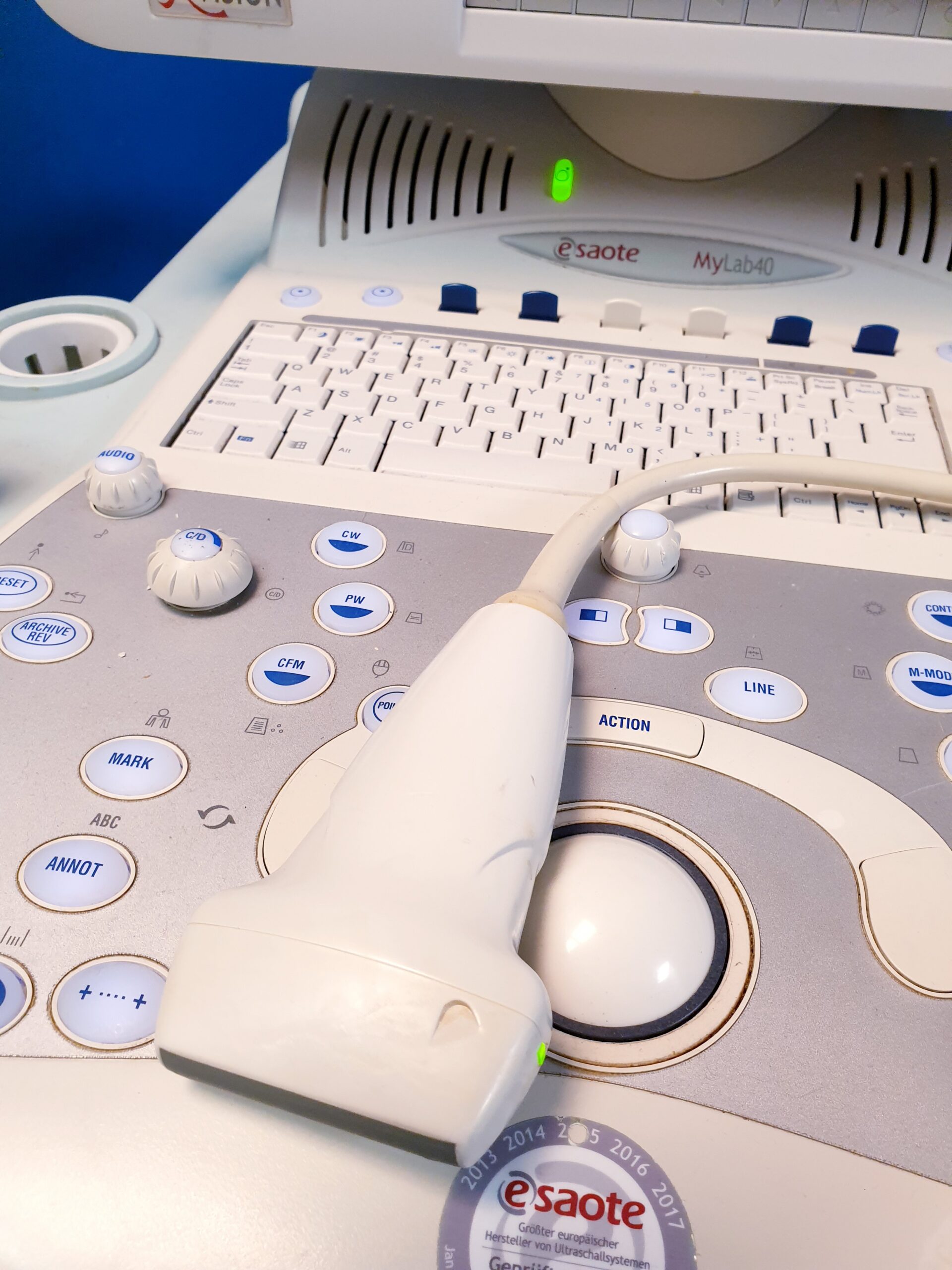 Esaote Mylab 40 + CA431 + LA523 + PA230 fARBDOPPLER – 2666- E2799 – ep thumbnail 5