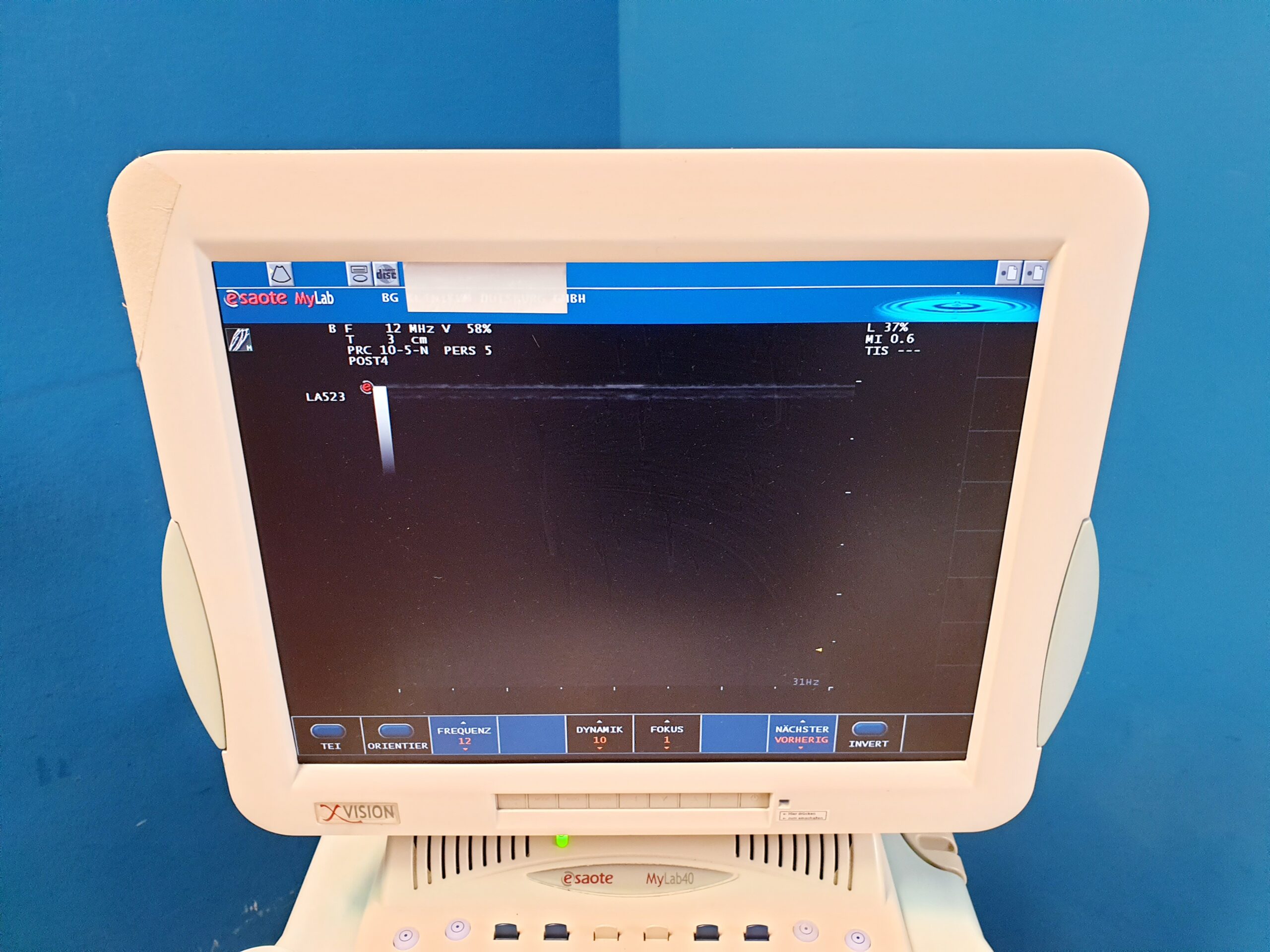 Esaote Mylab 40 + CA431 + LA523 + PA230 fARBDOPPLER – 2666- E2799 – ep thumbnail 7
