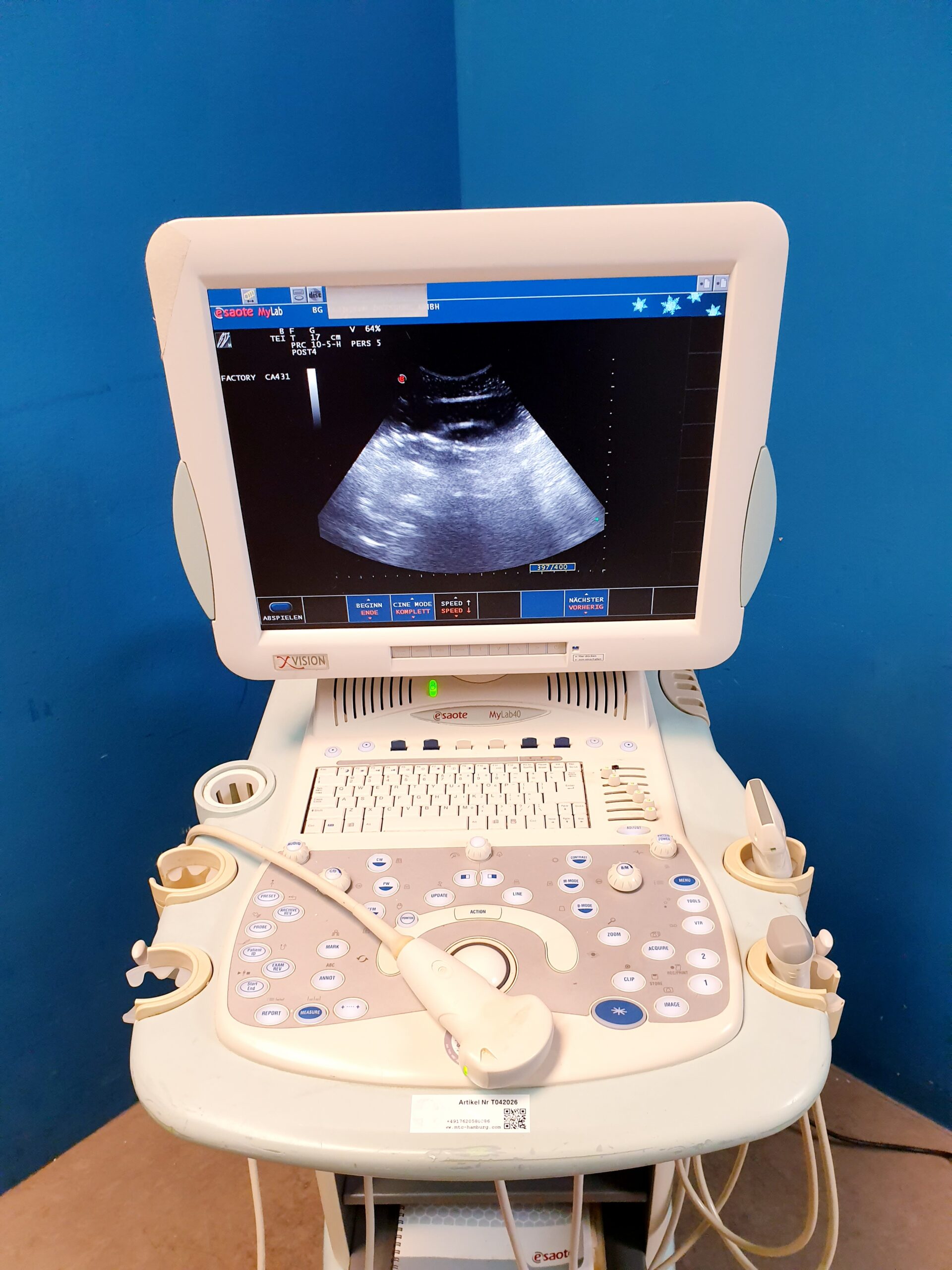 Esaote Mylab 40 + CA431 + LA523 + PA230 fARBDOPPLER – 2666- E2799 – ep thumbnail 9