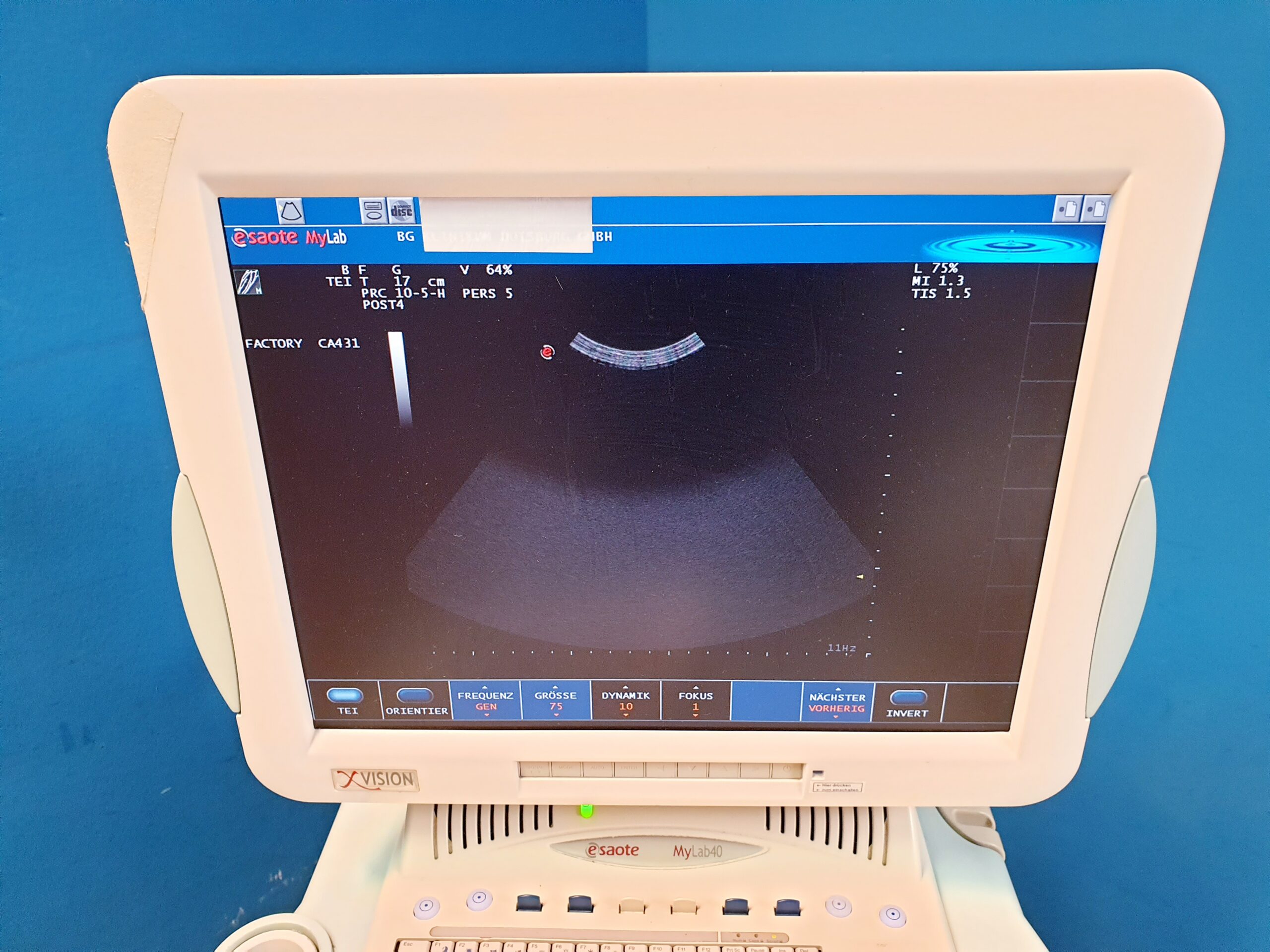 Esaote Mylab 40 + CA431 + LA523 + PA230 fARBDOPPLER – 2666- E2799 – ep thumbnail 10