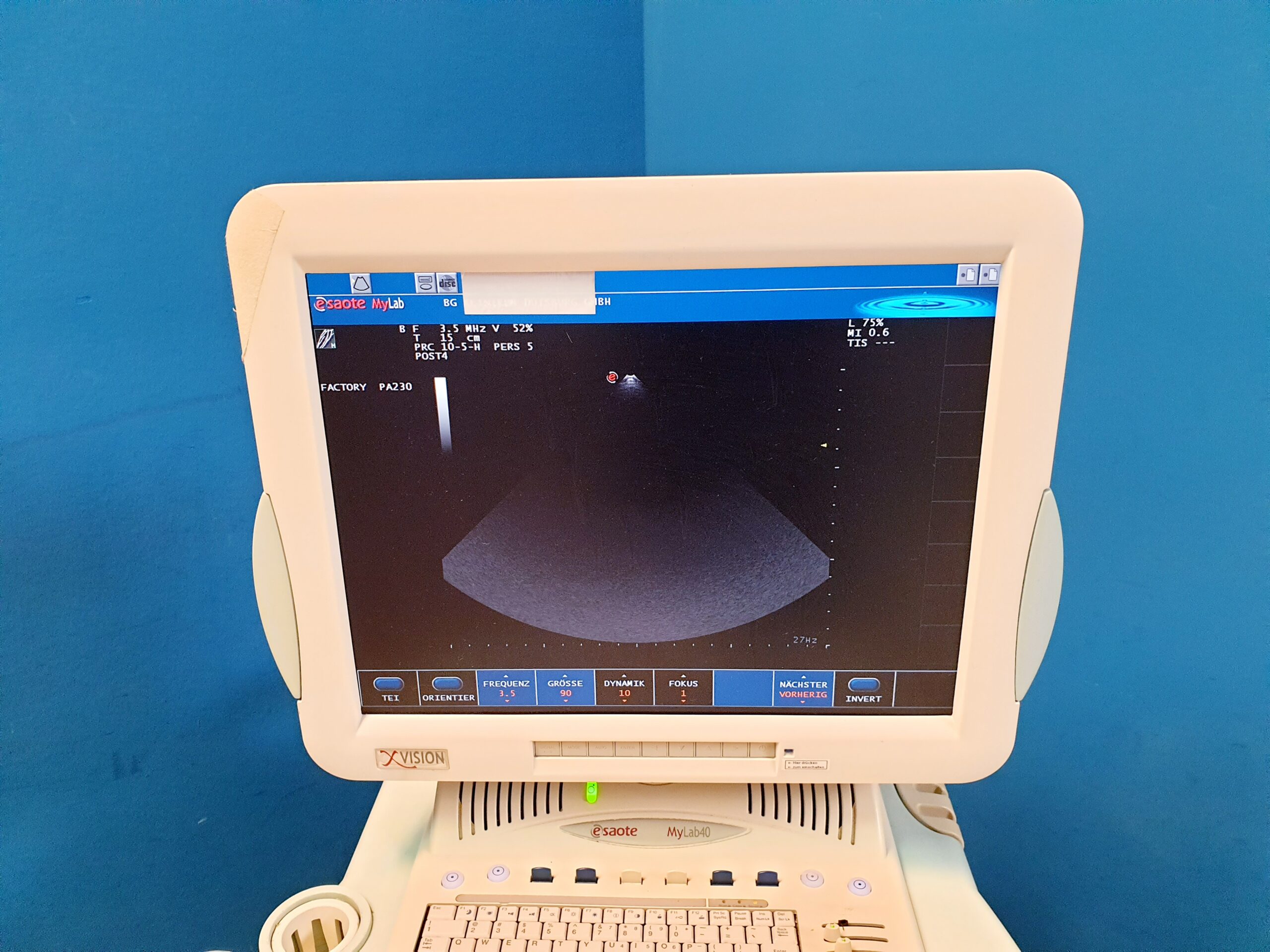 Esaote Mylab 40 + CA431 + LA523 + PA230 fARBDOPPLER – 2666- E2799 – ep thumbnail 15