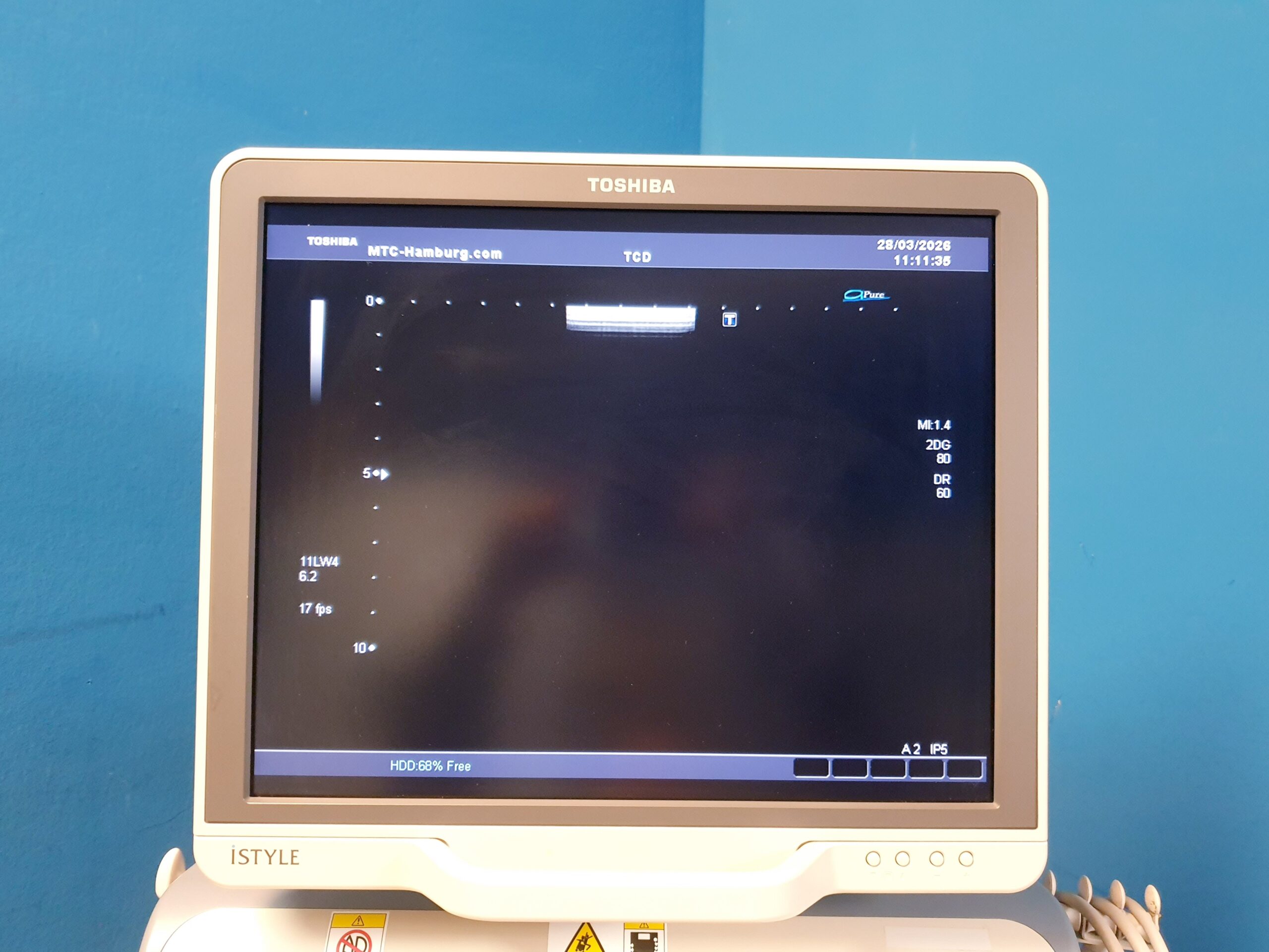 Toshiba SSA-680A Xario XG Farbdoppler + PLT-1204BT + PLT-1704SBT +PST-25BT – thumbnail 14