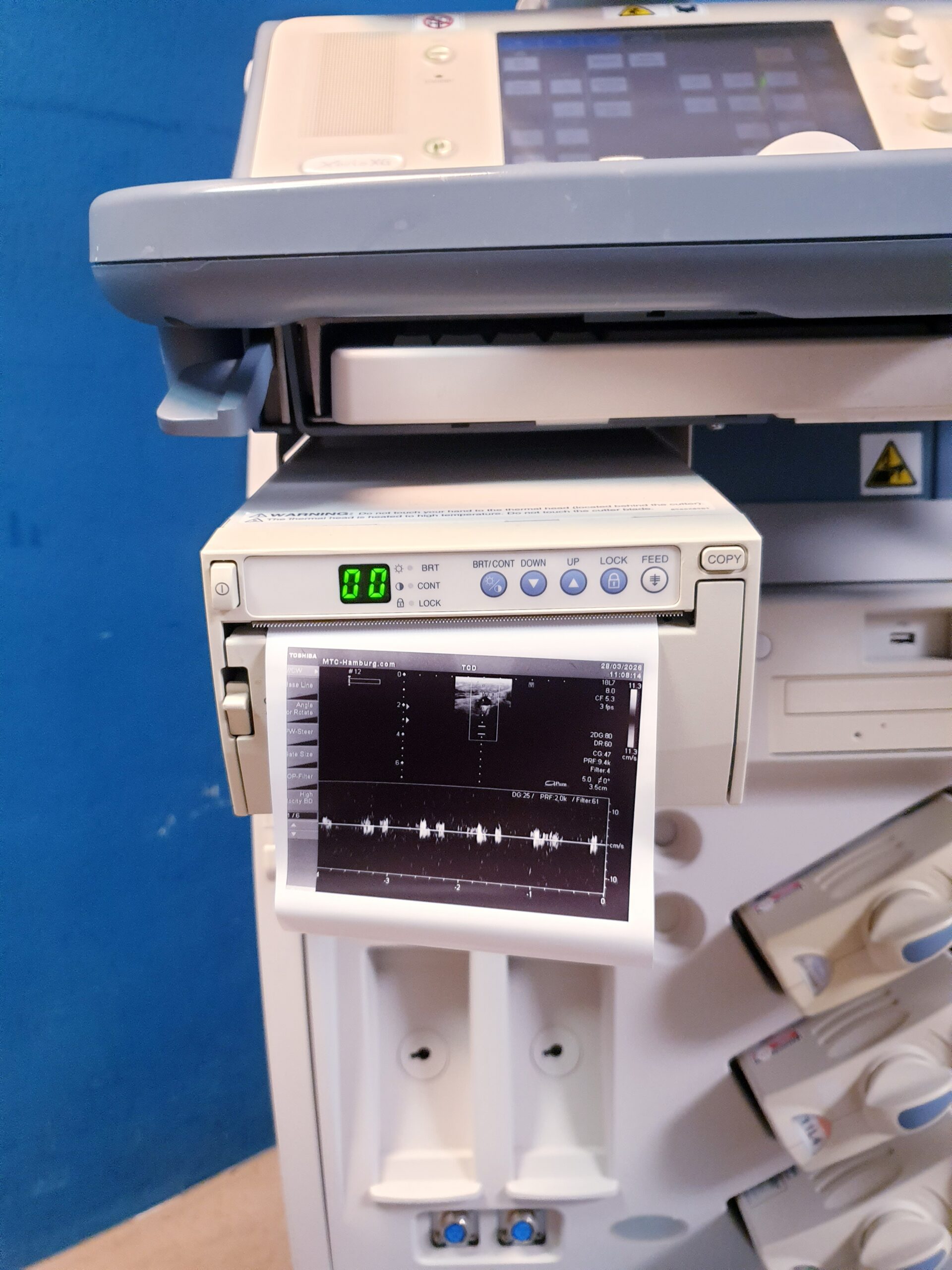 Toshiba SSA-680A Xario XG Farbdoppler + PLT-1204BT + PLT-1704SBT +PST-25BT – thumbnail 22
