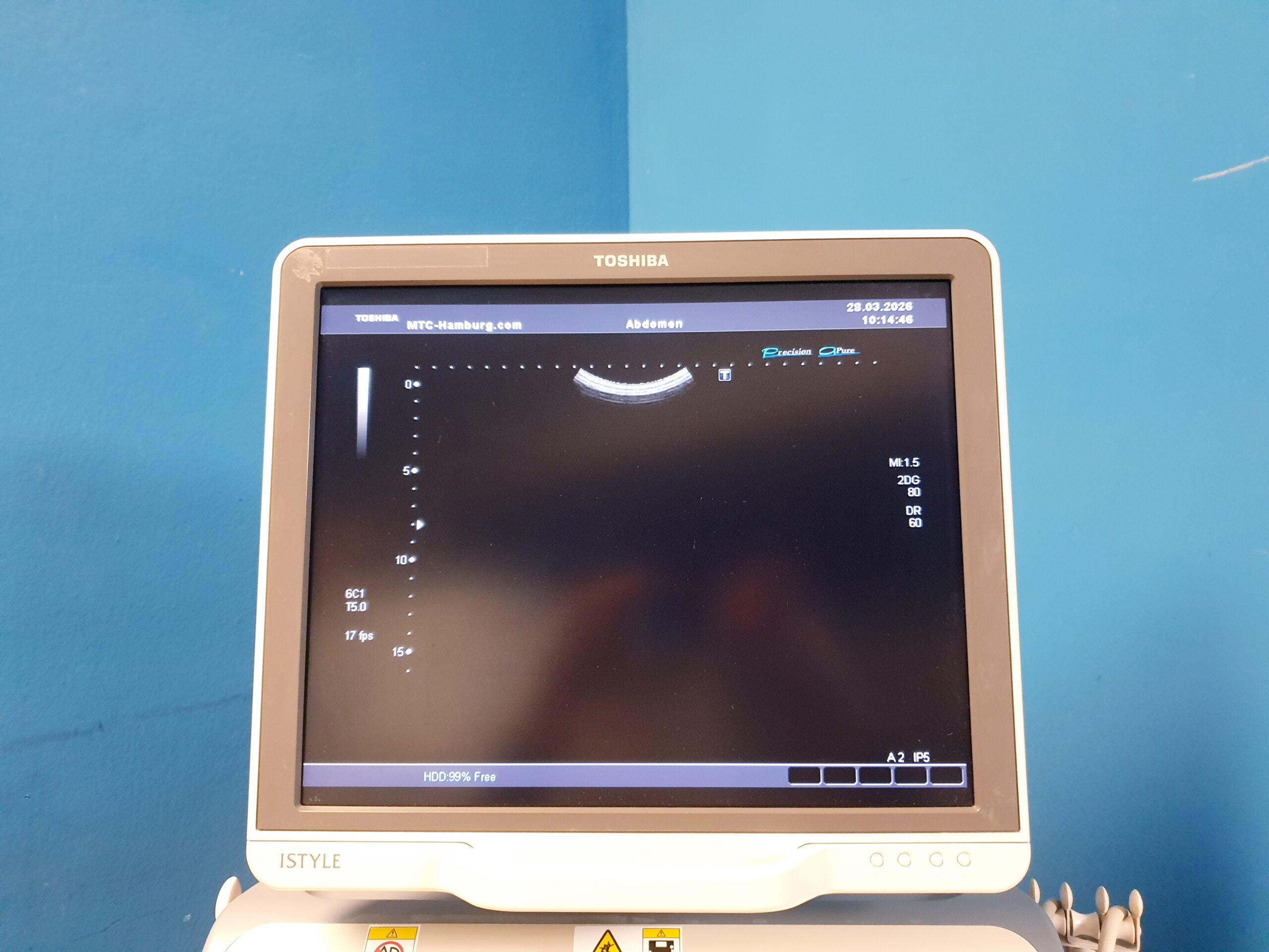Toshiba SSA-680A Xario XG Farbdoppler + PVT-375BT +PLT-805AT + PVT-661VT thumbnail 17