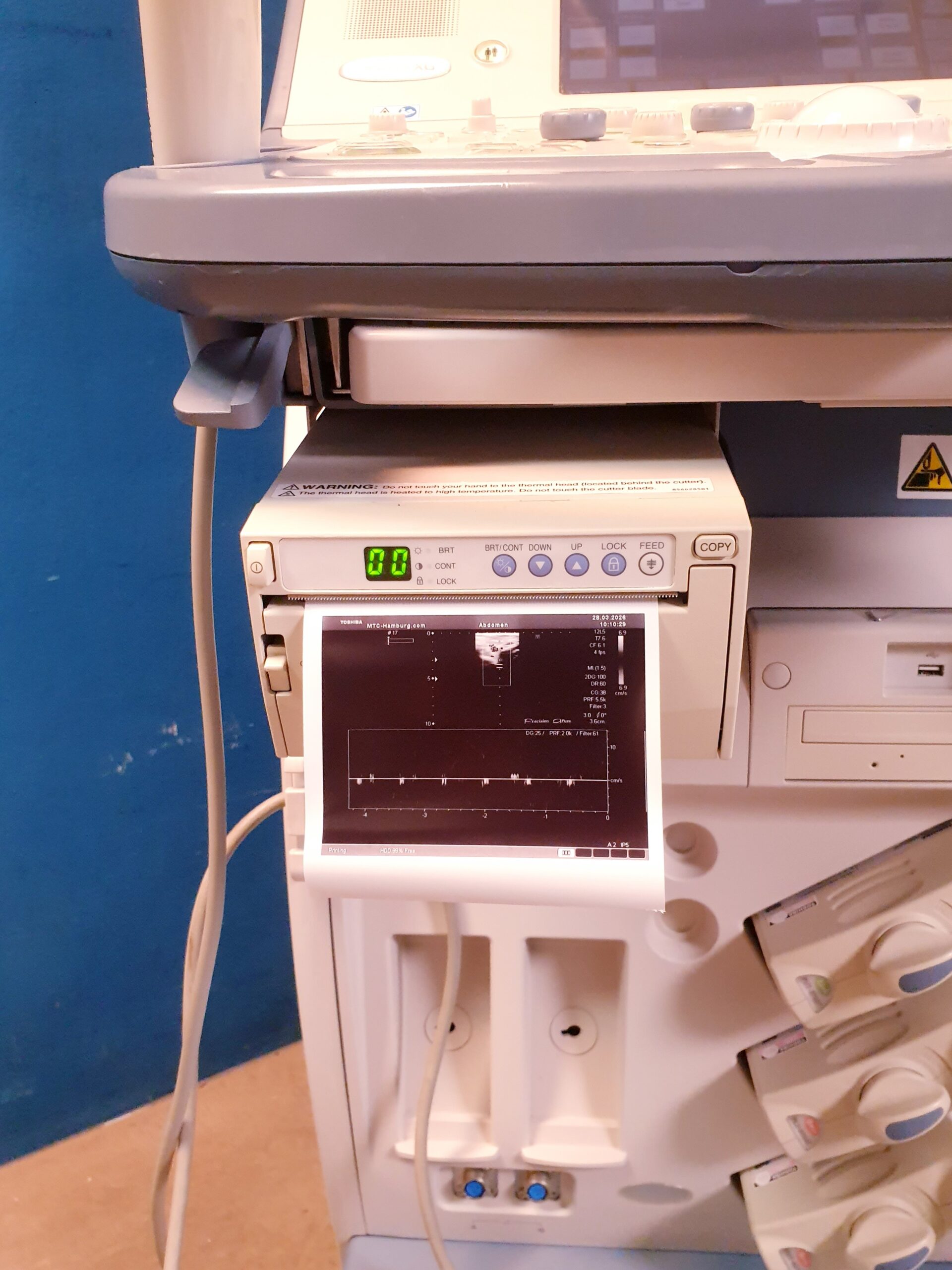 Toshiba SSA-680A Xario XG Farbdoppler + PVT-375BT +PLT-805AT + PVT-661VT thumbnail 22