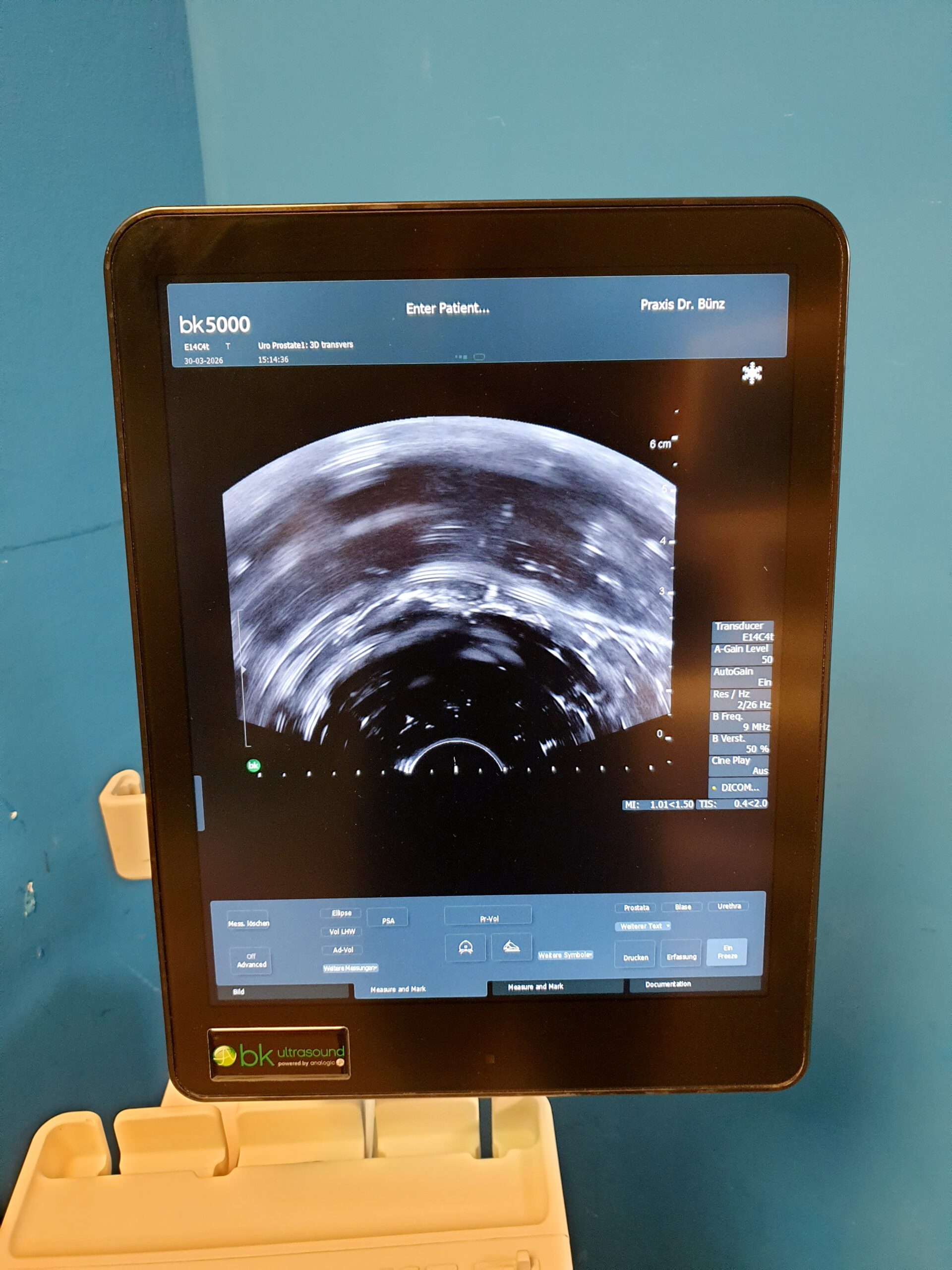 B&K BK-Medical BK-5000 Ultraschall + UA1325 E14C4t Transducer thumbnail 20