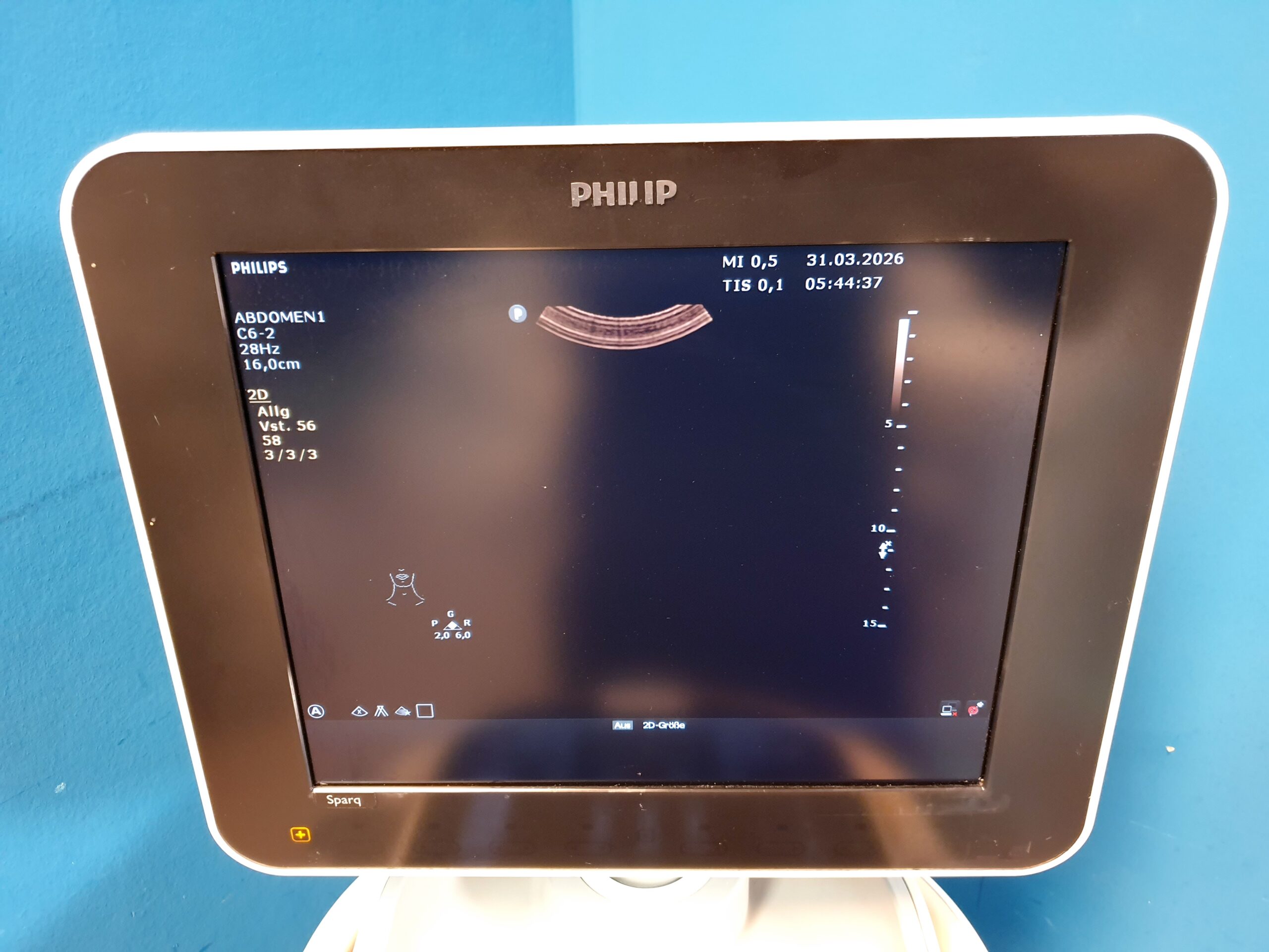 Philips Sparq C6-2 CW- Farbdoppler thumbnail 13