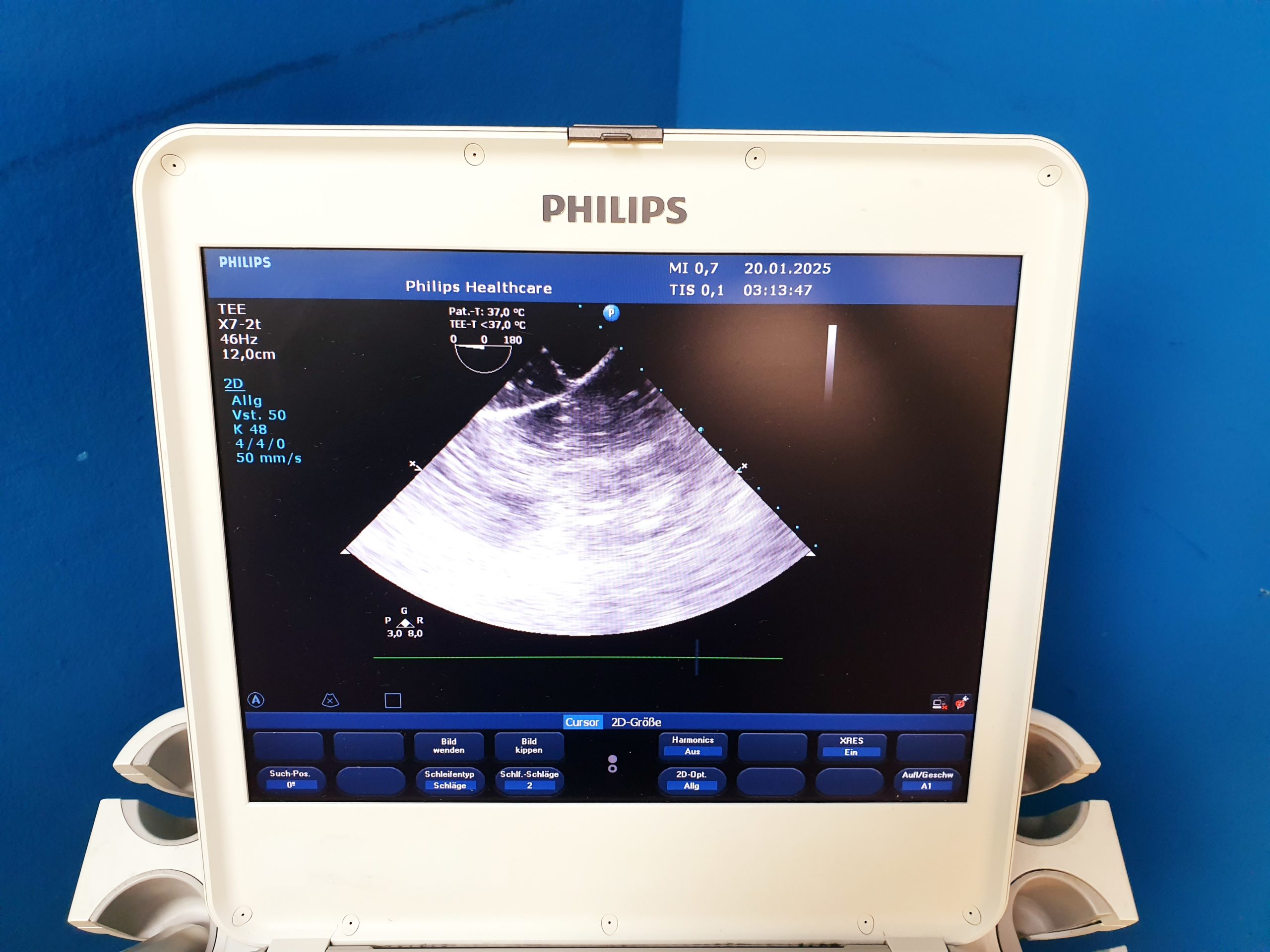 Philips X7-2t xMATRIX TEE-Sonde thumbnail 6