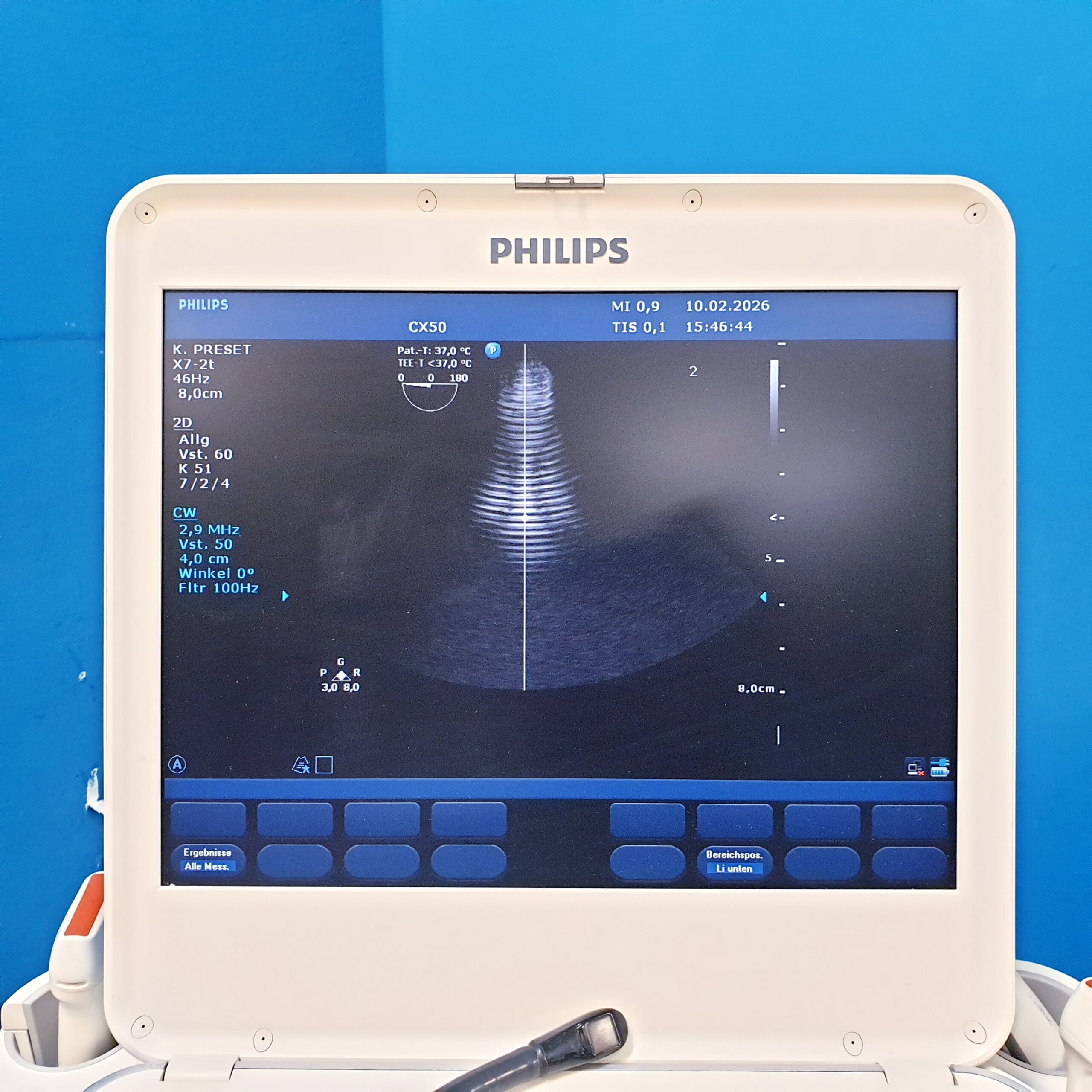 Philips X7-2t xMATRIX TEE-Sonde thumbnail 25