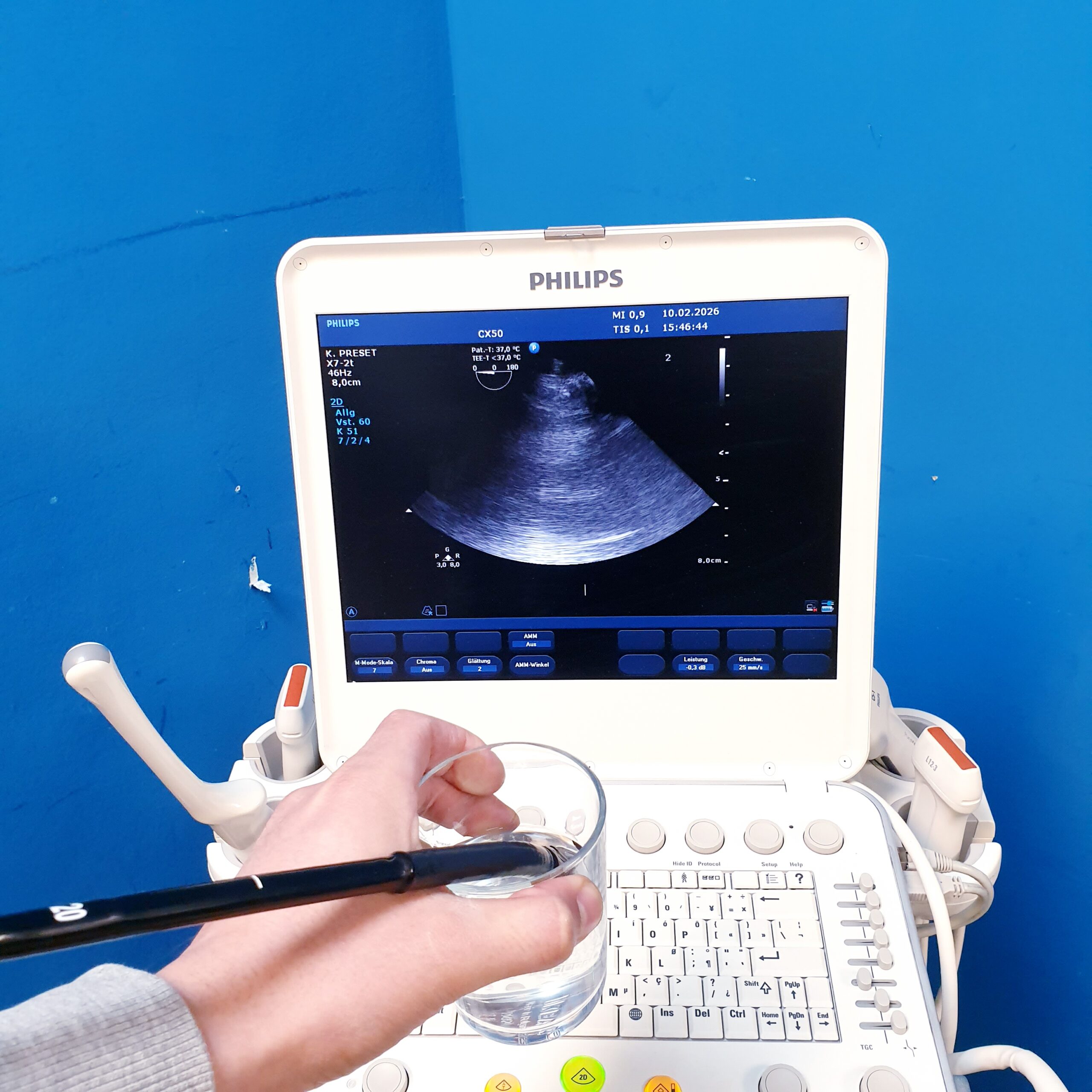 Philips X7-2t xMATRIX TEE-Sonde thumbnail 28