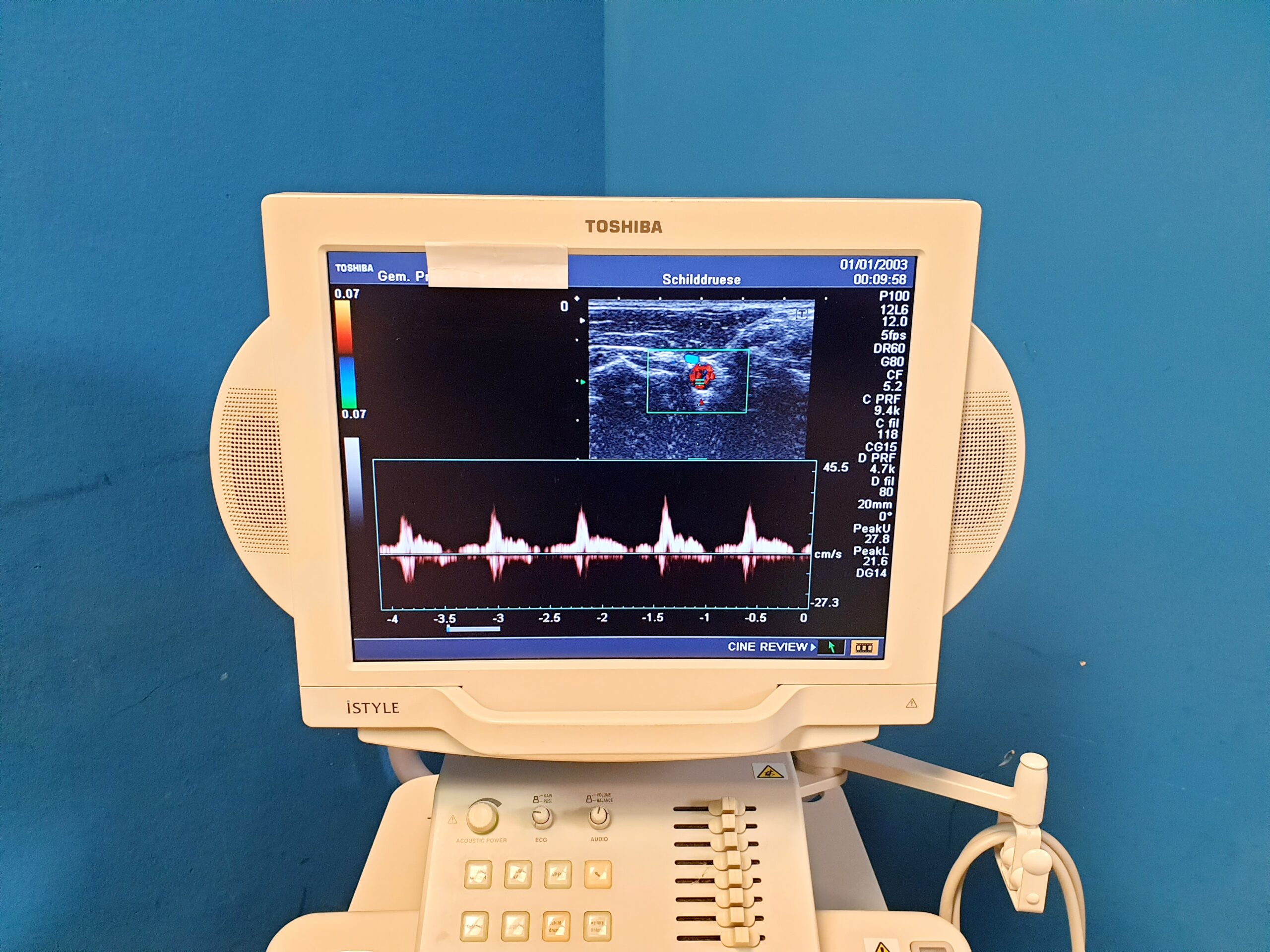 Toshiba Nemio XG SSA-580A – PVM-375AT – PLM-805AT – Farbdoppler Doppler thumbnail 4