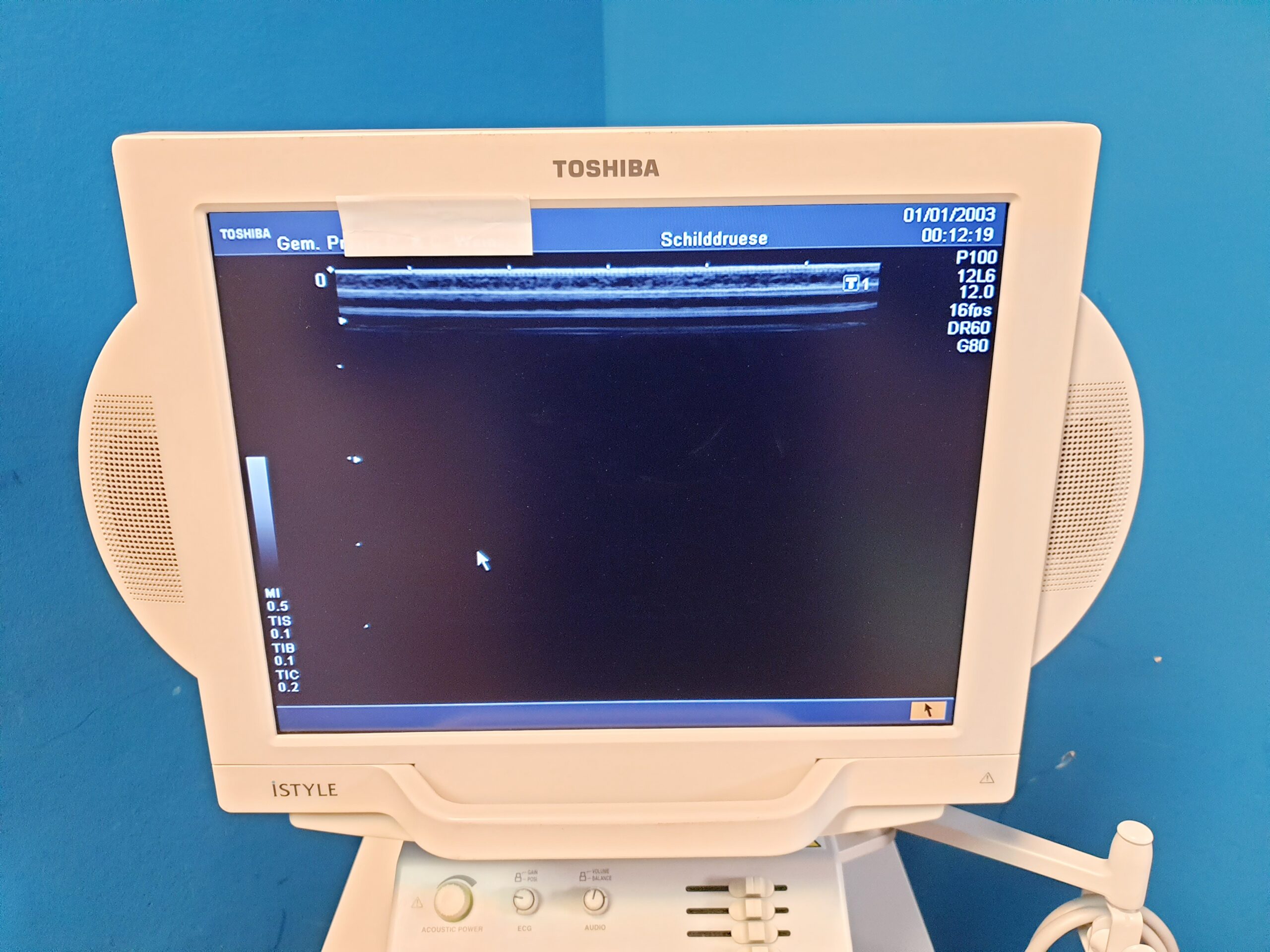 Toshiba Nemio XG SSA-580A – PVM-375AT – PLM-805AT – Farbdoppler Doppler thumbnail 10