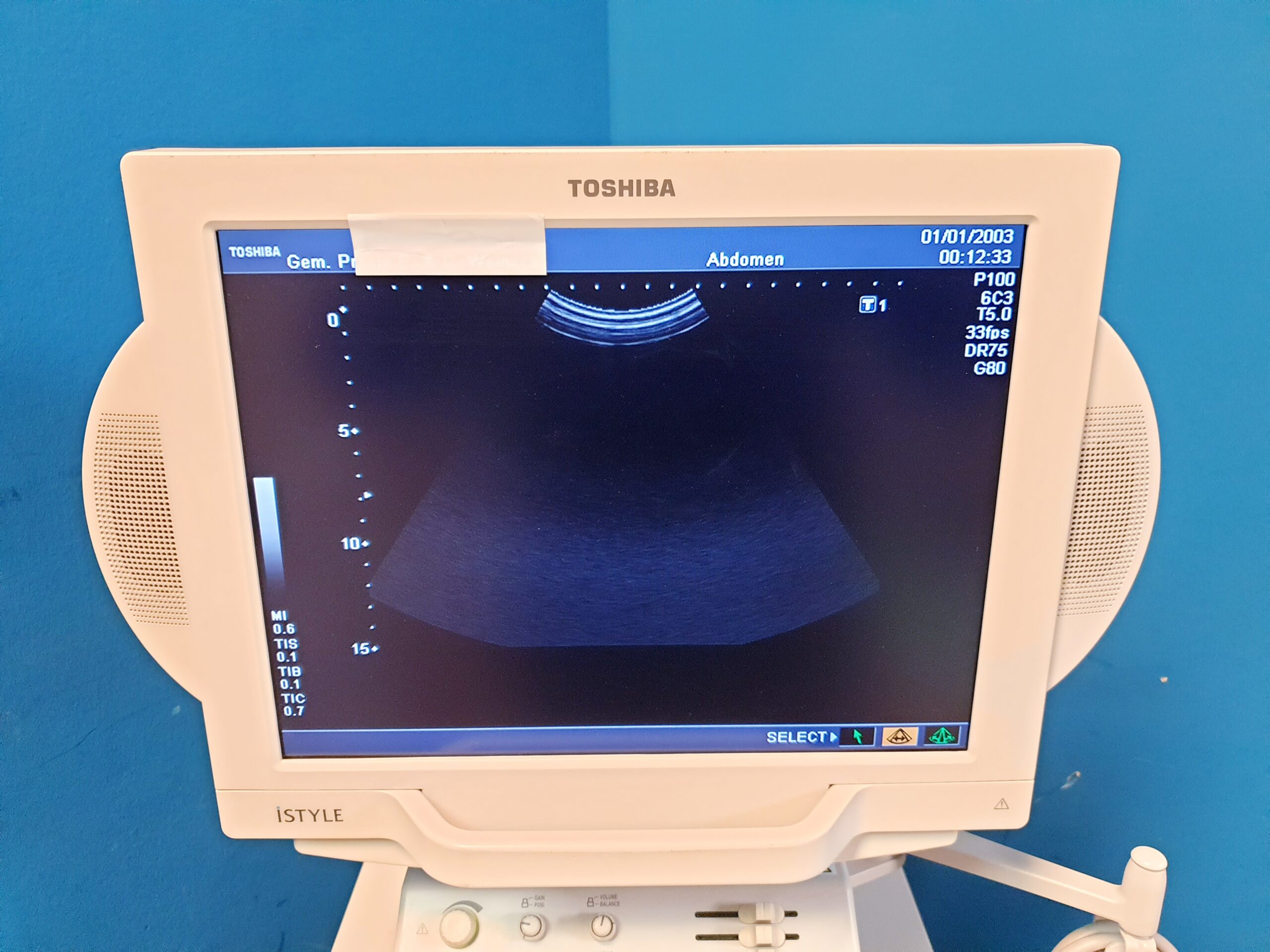 Toshiba Nemio XG SSA-580A – PVM-375AT – PLM-805AT – Farbdoppler Doppler thumbnail 12