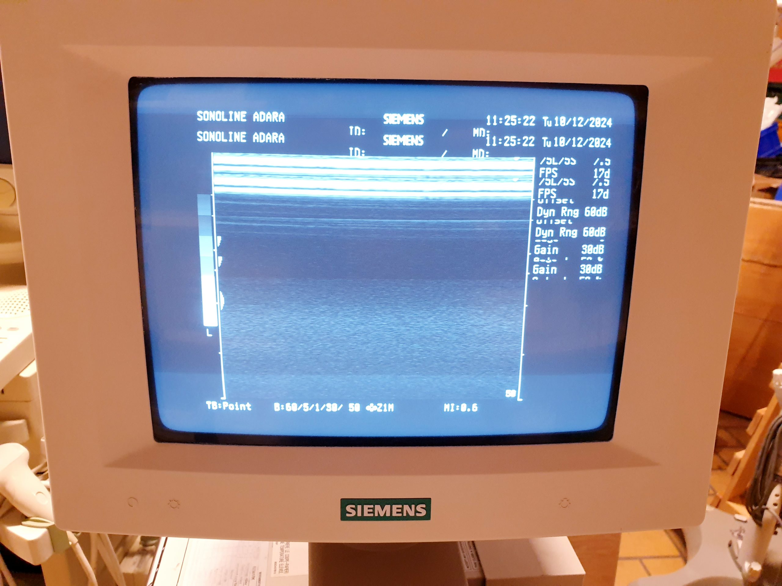 Siemens 7.5L75S Linear Sonde 7.5MHz thumbnail 3