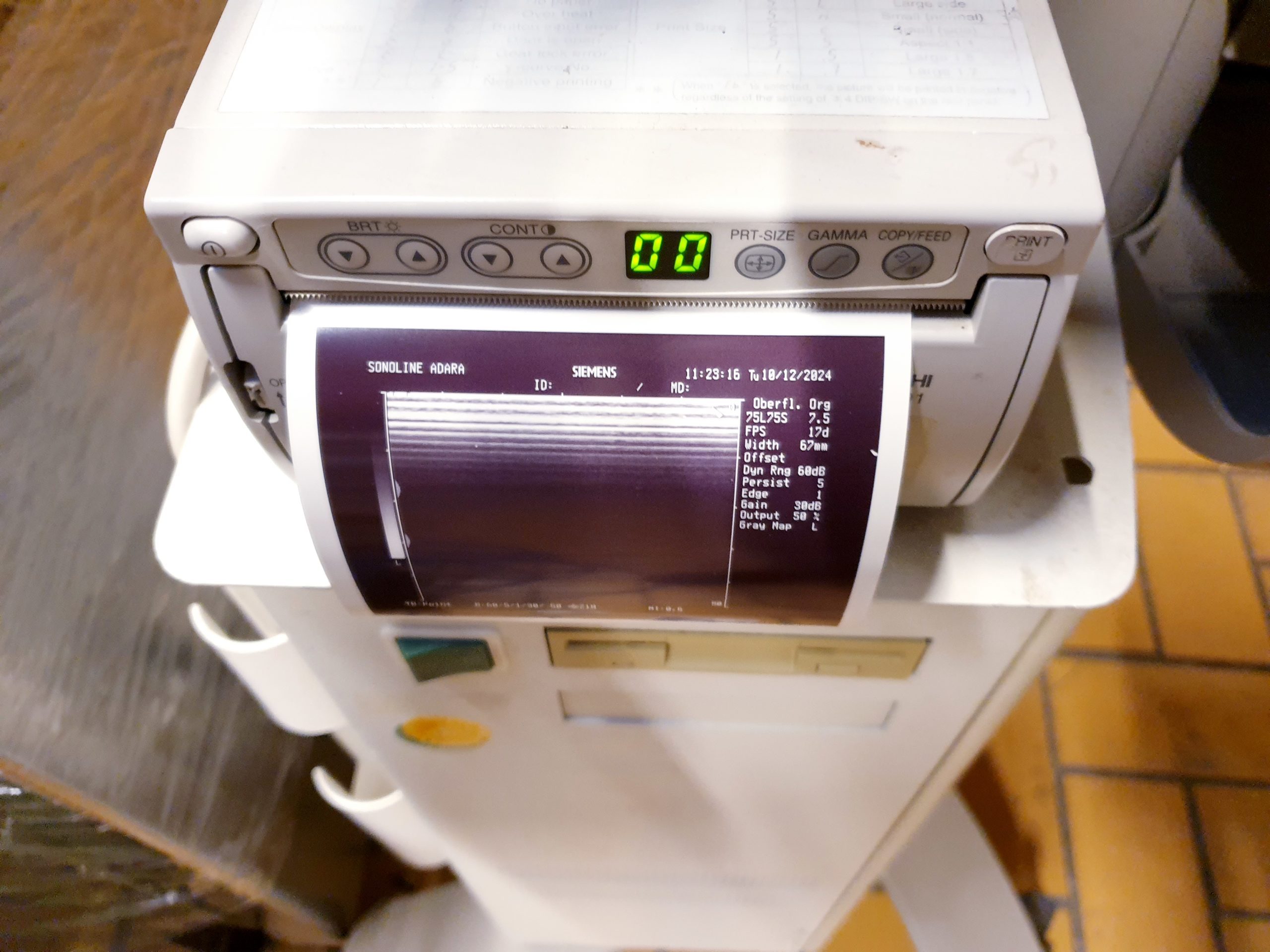Siemens 7.5L75S Linear Sonde 7.5MHz thumbnail 4