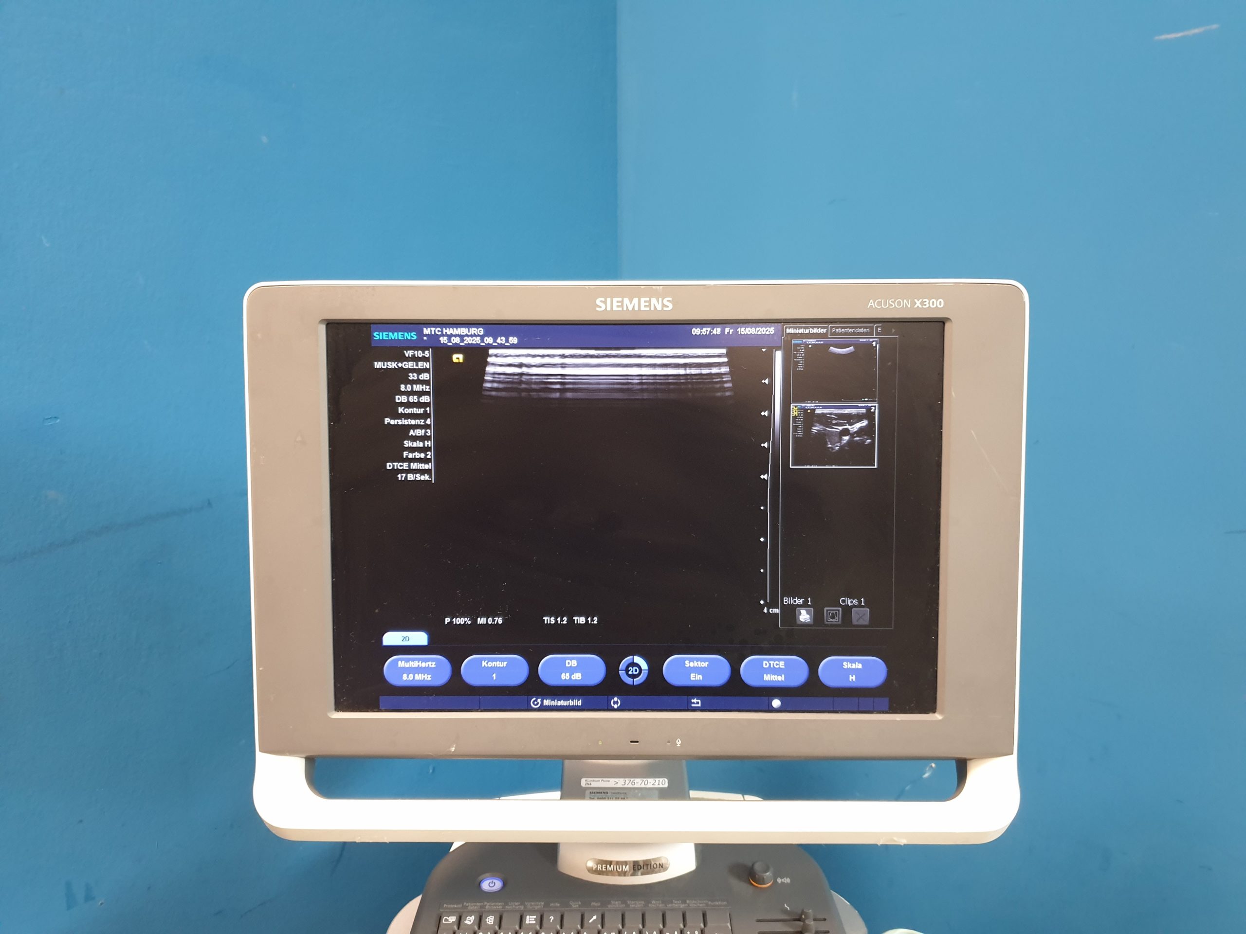 SIEMENS ACUSON X300 X 300 Premium Edition + CH5-2 Konvex + VF10-5 Linear + P5-1 thumbnail 8