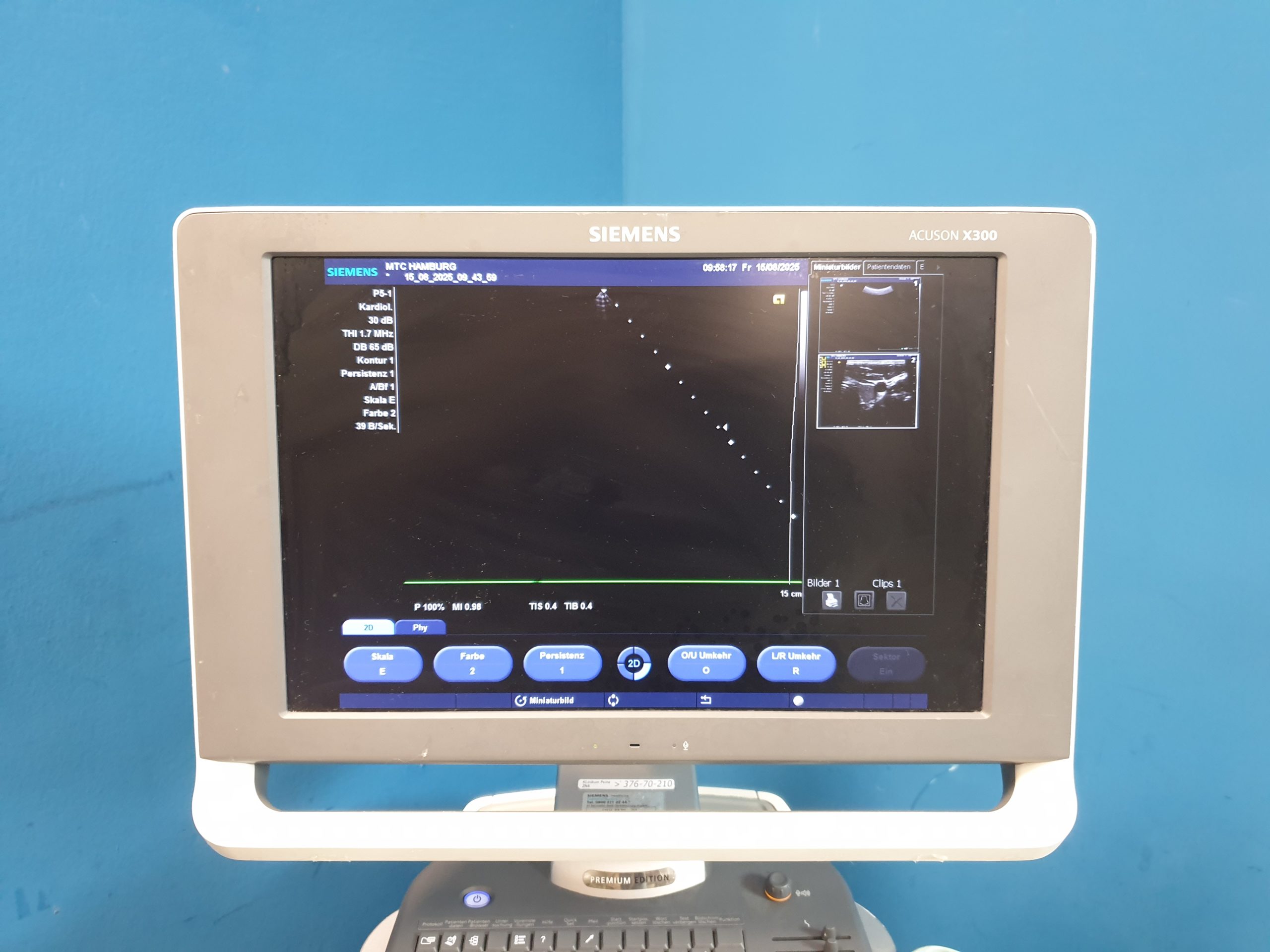 SIEMENS ACUSON X300 X 300 Premium Edition + CH5-2 Konvex + VF10-5 Linear + P5-1 thumbnail 10