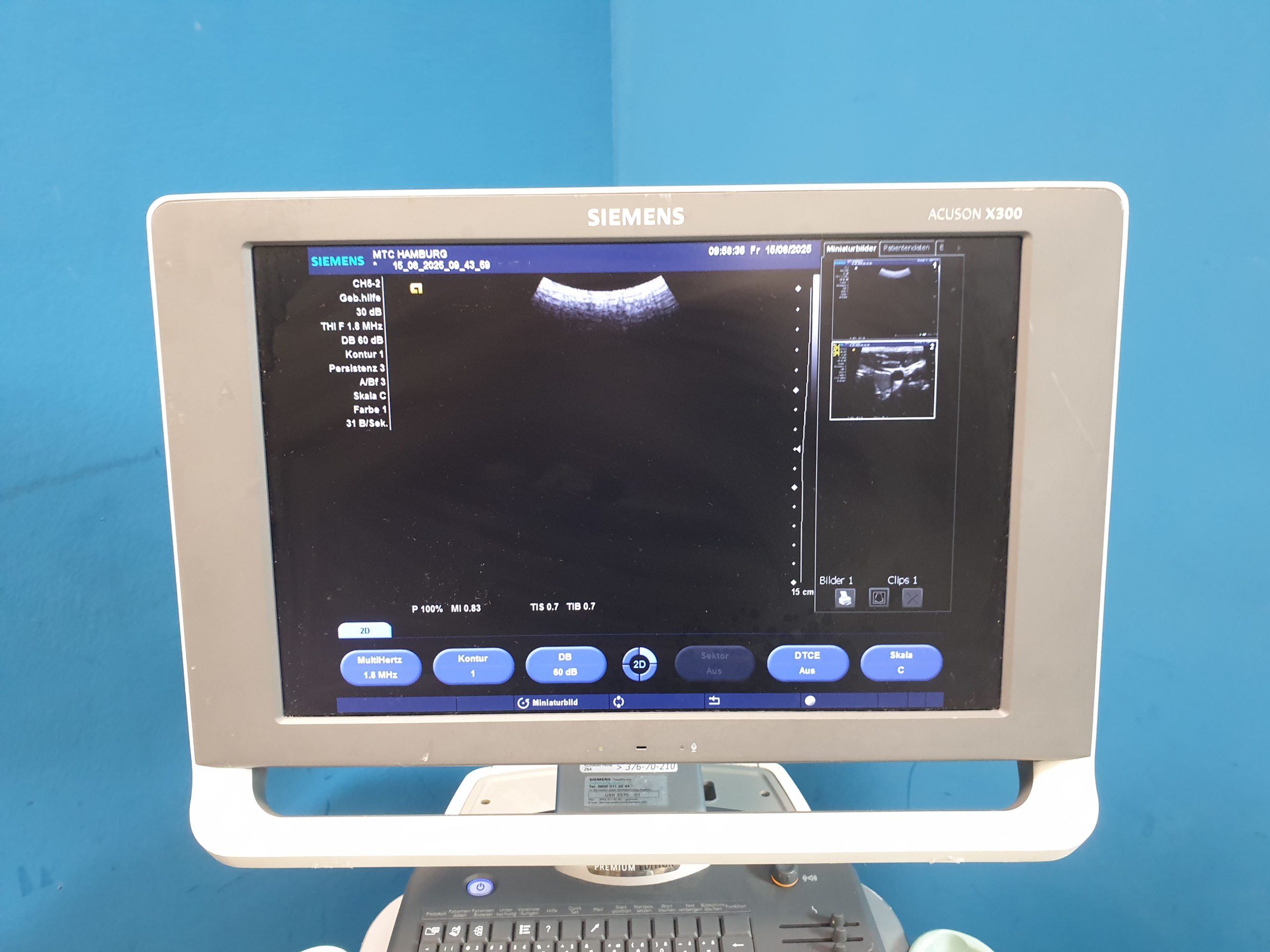 SIEMENS ACUSON X300 X 300 Premium Edition + CH5-2 Konvex + VF10-5 Linear + P5-1 thumbnail 13