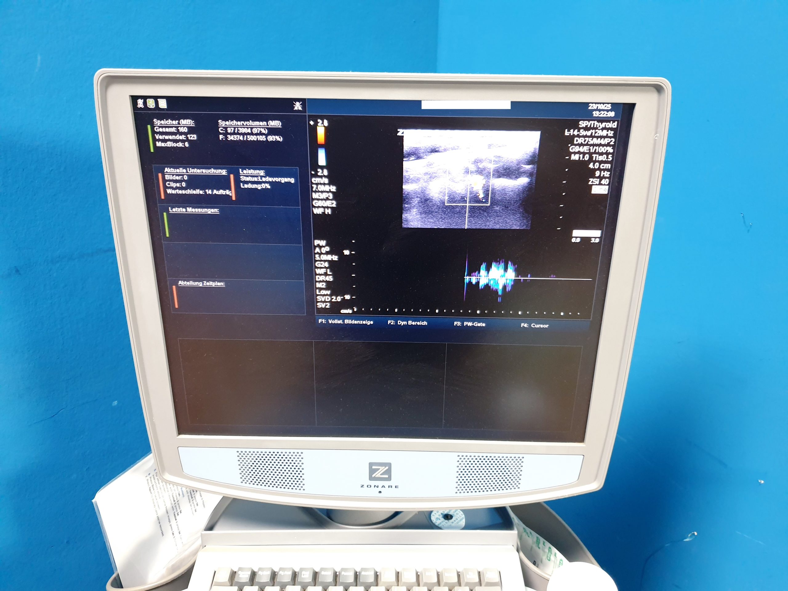 Zonare – Doppler Farbdoppler Ultraschallsystem 3 Sonden L14-5w + C9-3 + C10-3 thumbnail 6