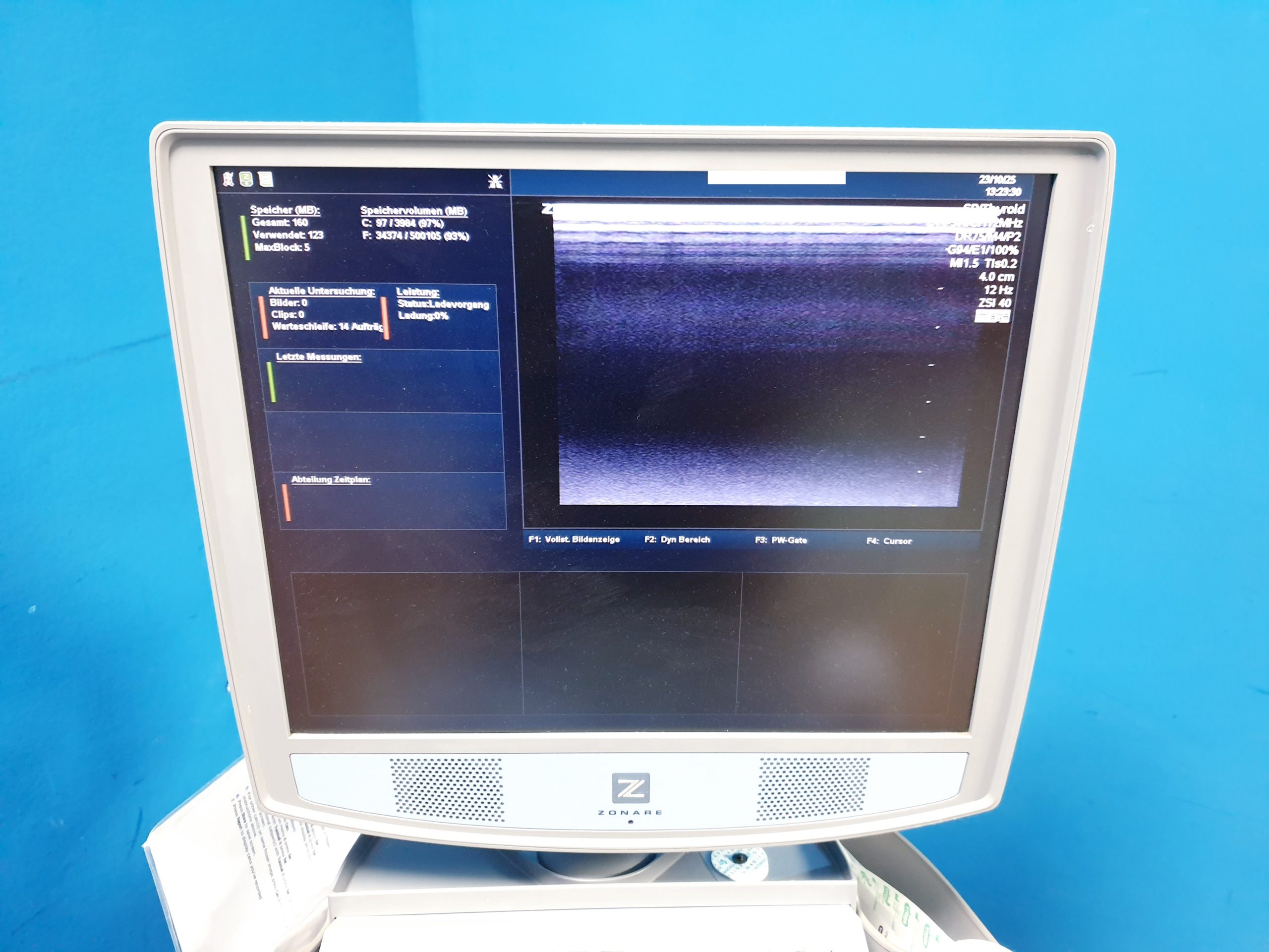 Zonare – Doppler Farbdoppler Ultraschallsystem 3 Sonden L14-5w + C9-3 + C10-3 thumbnail 9