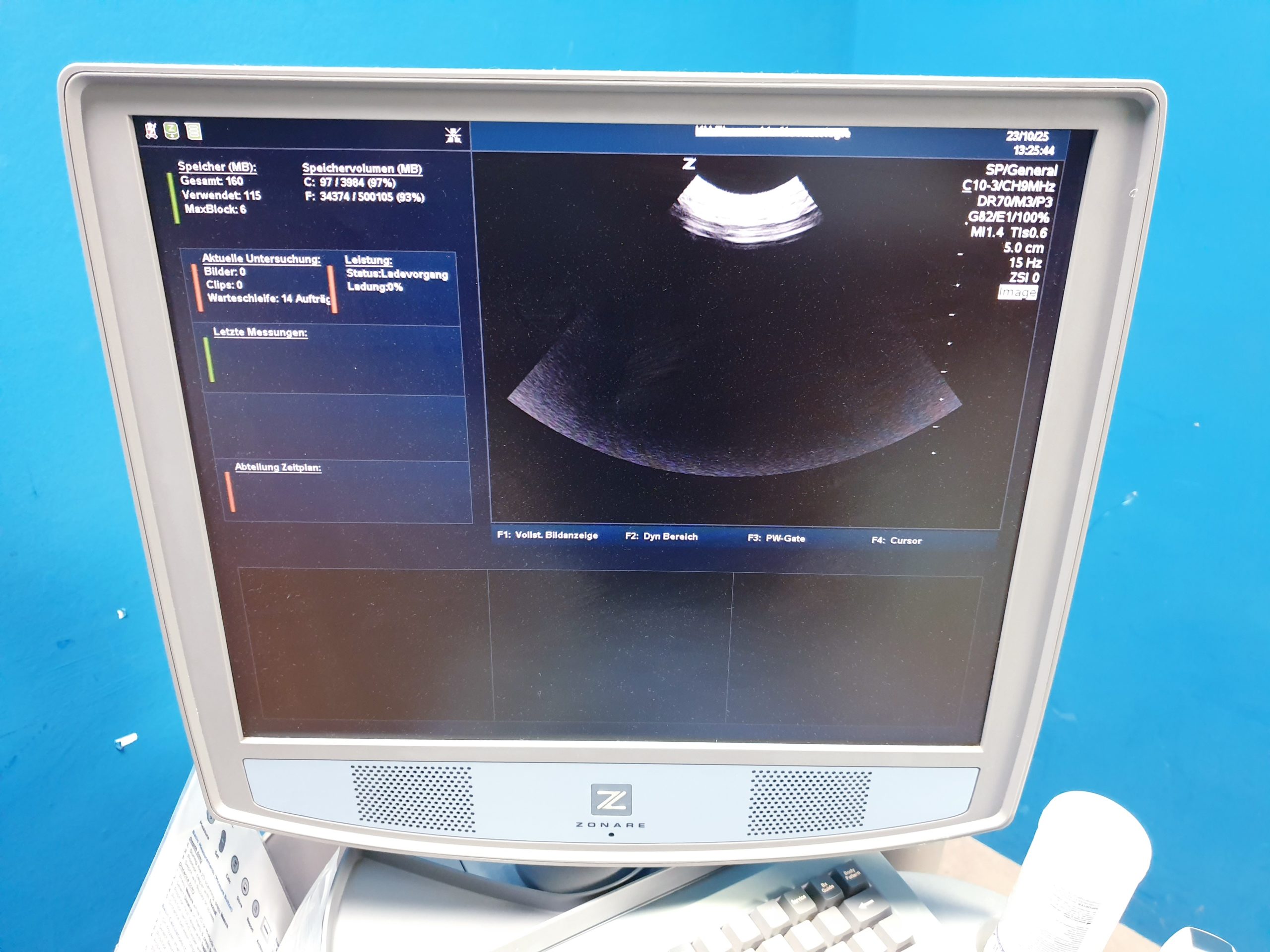 Zonare – Doppler Farbdoppler Ultraschallsystem 3 Sonden L14-5w + C9-3 + C10-3 thumbnail 16