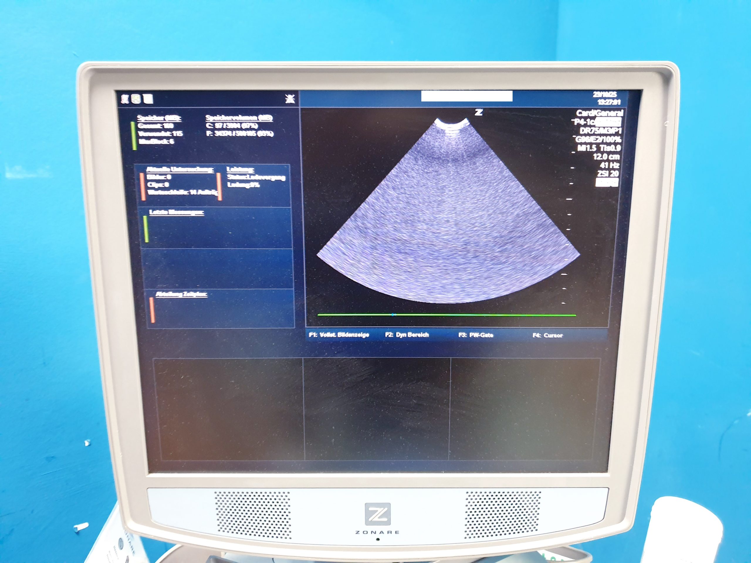 Zonare – Doppler Farbdoppler Ultraschallsystem 3 Sonden L14-5w + C9-3 + C10-3 thumbnail 20