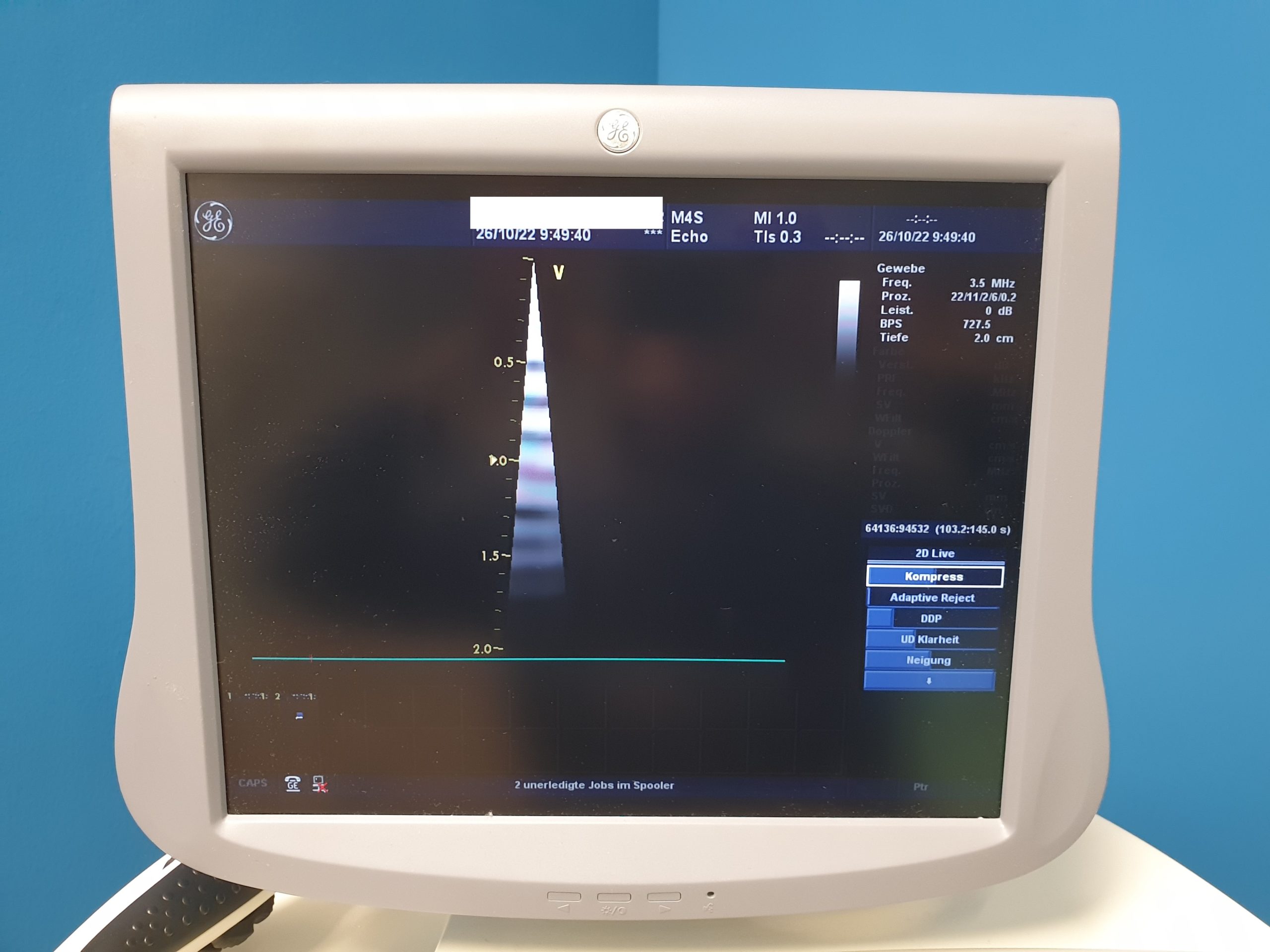 GE Vivid 7 Dimension mit GE M4S Echo Kardio Sonde + 9L Linear + 4C Konvex + 3V Volumencardio + 6TC TEE Sonde thumbnail 6