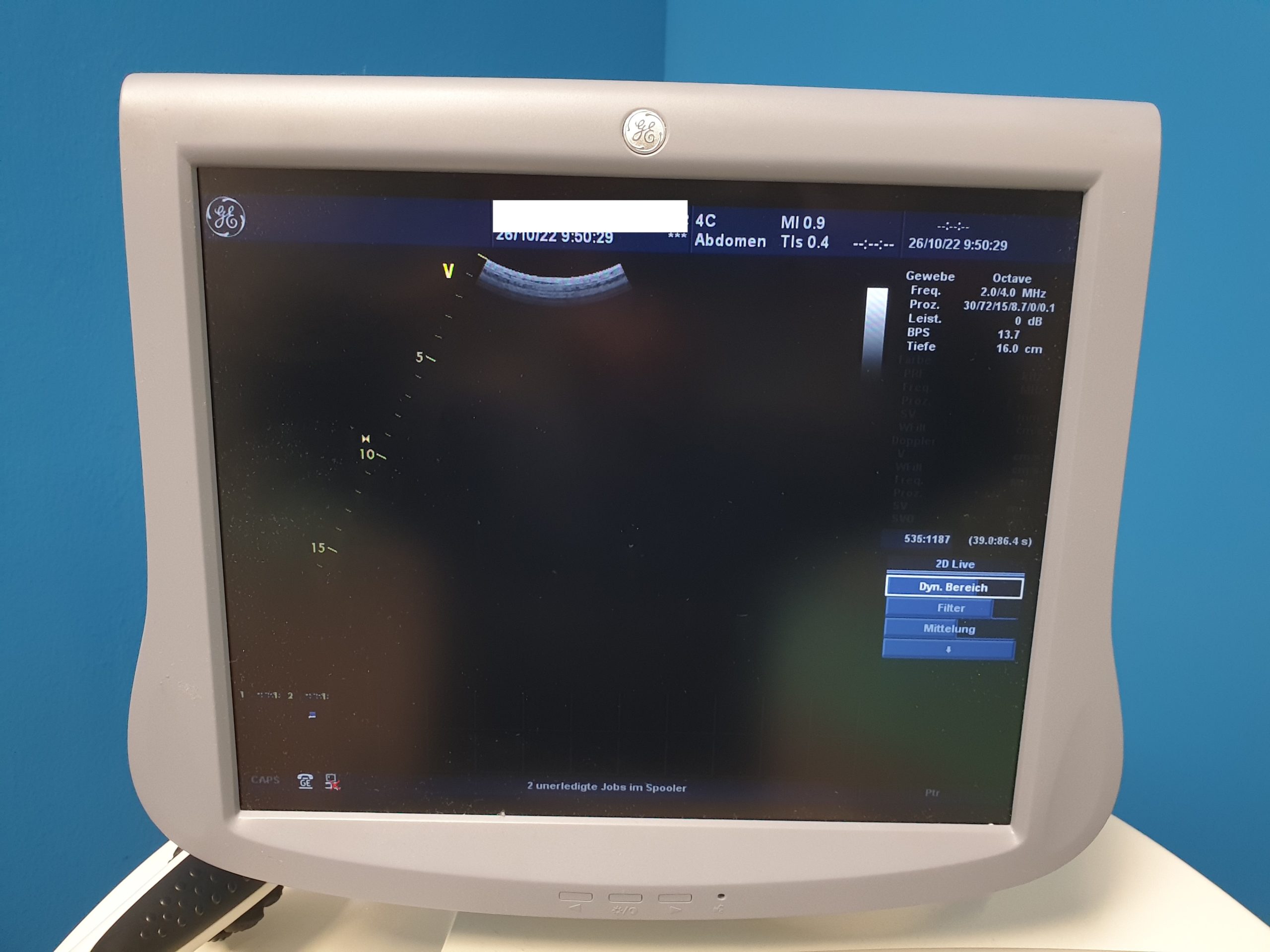 GE Vivid 7 Dimension mit GE M4S Echo Kardio Sonde + 9L Linear + 4C Konvex + 3V Volumencardio + 6TC TEE Sonde thumbnail 8
