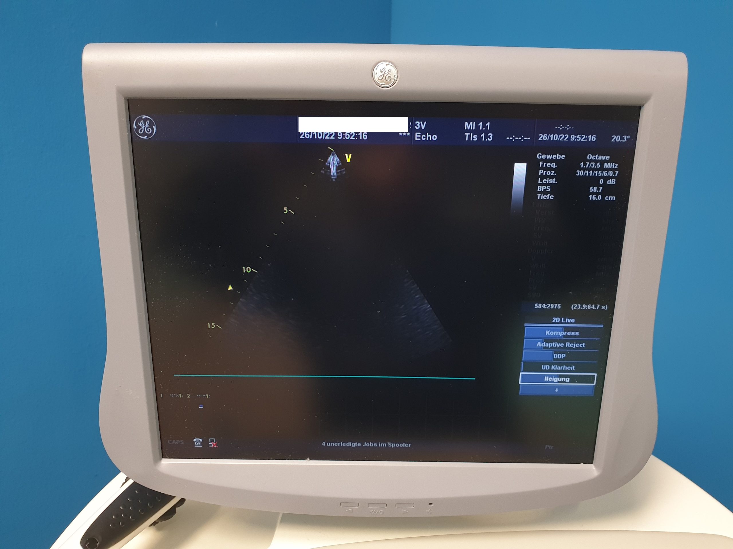 GE Vivid 7 Dimension mit GE M4S Echo Kardio Sonde + 9L Linear + 4C Konvex + 3V Volumencardio + 6TC TEE Sonde thumbnail 12